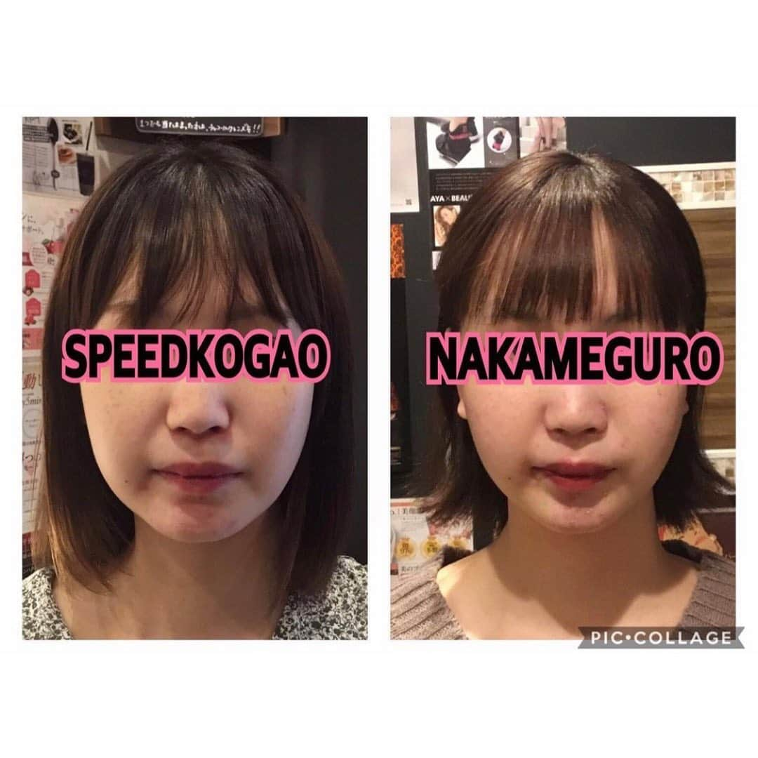 小顔.小顔矯正.Speed小顔公式アカウントさんのインスタグラム写真 - (小顔.小顔矯正.Speed小顔公式アカウントInstagram)「✍️口コミ＆ビフォー/アフター __________________________ @speedkogao の年間症例数は、55万件！  #スピード小顔 の 口コミの平均スコアは4以上！ ★★★★⭐︎✌🏻  みなさん、たくさん口コミありがとうございます！  また、お客様からのフィードバック(口コミ)を元に独自の接客プログラムを組み研修をしています✨  リアルな口コミなどをみたい方は、Google検索やホットペッパービューティをご覧くださいね💻✨  毎回、ご来店いただいた際は Before➡︎After のお写真を撮影させていただきます。  施術前後のご自身の変化をしっかり確認してもらい、効果や変化を実感してもらうことを大切にしています✨  人気の100円ハイフなど気軽に小顔体験をしていただけるキャンペーンも実施していますので、ぜひこの機会に体験してください🙏🏻  皆さまのご来店お待ちしております❤️  #スピード小顔 #小顔美人 #むくみ解消 #小顔 #小顔になる方法  #美容家 #美活  #好印象フェイス  #コロナ対策万全  #ご予約お待ちしています❤️」2月8日 18時51分 - speedkogao