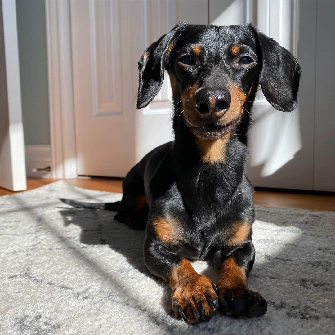 Crusoe the Celebrity Dachshundのインスタグラム：「UPDATE:  It’s been just over 3 weeks since Crusoe’s surgery/biopsy at Cornell, and we just did his first blood test since then.  We can’t describe how happy we are to report that Crusoe’s liver enzymes have dropped down dramatically are almost in the normal range!!! This was an even better result than we could have thought! I think it shows that clearing his bile duct of the residual debris/sand was affecting him the most, even though he still does have a degree of pancreatitis and IBD that we will still try to settle out with a hypoallergenic diet.  We want to be slightly cautious, as we’ve been burned in the past where we had a good test only to be followed by a bad test. But having now cleaned out his duct, and with the best test numbers he’s had since his original surgery in June, we’re feeling optimistic for the first time in a long time.  So much so that we are going to be launching the Crusoe Fund at @cornellvet in the next week or so as a thank you and to raise money for their research and care to help more animals like Crusoe in the future. And we will be matching the donations made by fans.   Thank you once again to all our incredible caring fans, we love you guys ❤️❤️❤️」