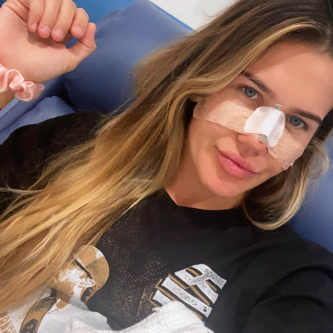 シャルロッテ・キャスリックのインスタグラム：「All better 🤍👃🏼 Thank you everyone for the very kind messages, I’ll be back full training in a couple of weeks!」