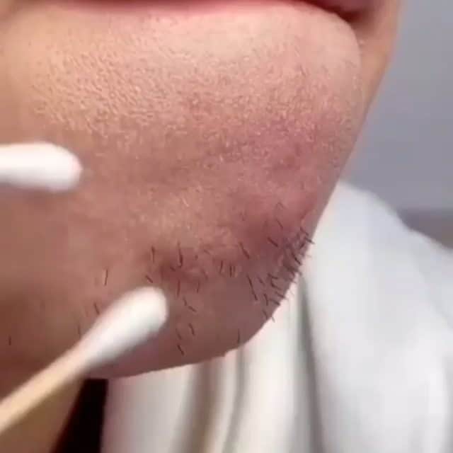 wonderful natureのインスタグラム：「This Green Tea Cleansing Mask Can Help Removes Your Blackhead And Acne Within Minutes. Perfect For Skin Cleaning And Improve Skin Radiance! - Order Link in bio of @paradigm__store . #fashiongoals  #fashionlove  #fashionphoto  #fashionbeauty  #fashionsta  #fashionistastyle  #fashionislife  #fashionism  #fashionismylife  #fashionforgood  #fashionforlife  #fashiontoday  #fashionforever  #fashionforyou  #beautytime  #fashiontime  #forbeauty  #forfashion  #loveforfashion  #lovefashionstyle  #lovefashion  #fashionblogg  #fashionismypassion  #fashiondresses  #beautyforlife  #beautytogether  #beautyispower  #beautyismybusiness  #fashionvideos  #fashionvideo」