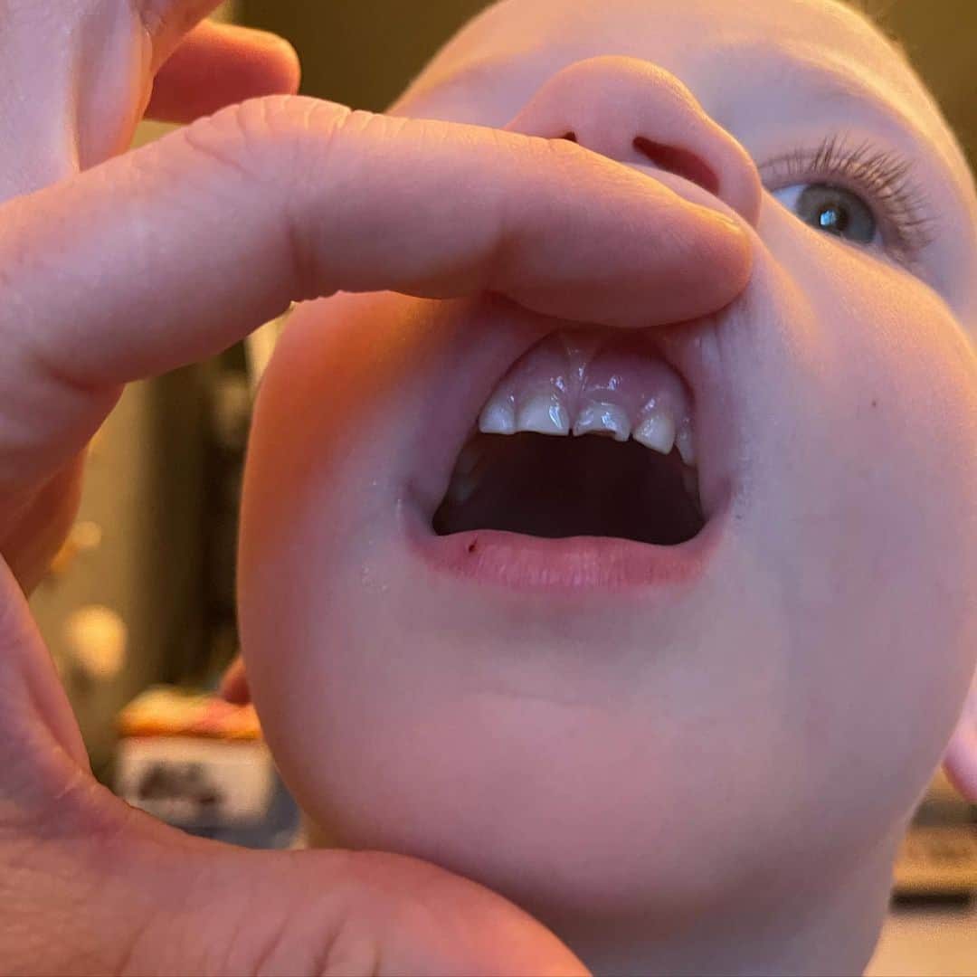 ニック・カーターさんのインスタグラム写真 - (ニック・カーターInstagram)「The life of a parent. He chipped his tooth a while ago and now we gotta get it operated on. Thankfully it’s only his baby tooth. ugh 🤦🏼‍♂️」2月15日 23時41分 - nickcarter