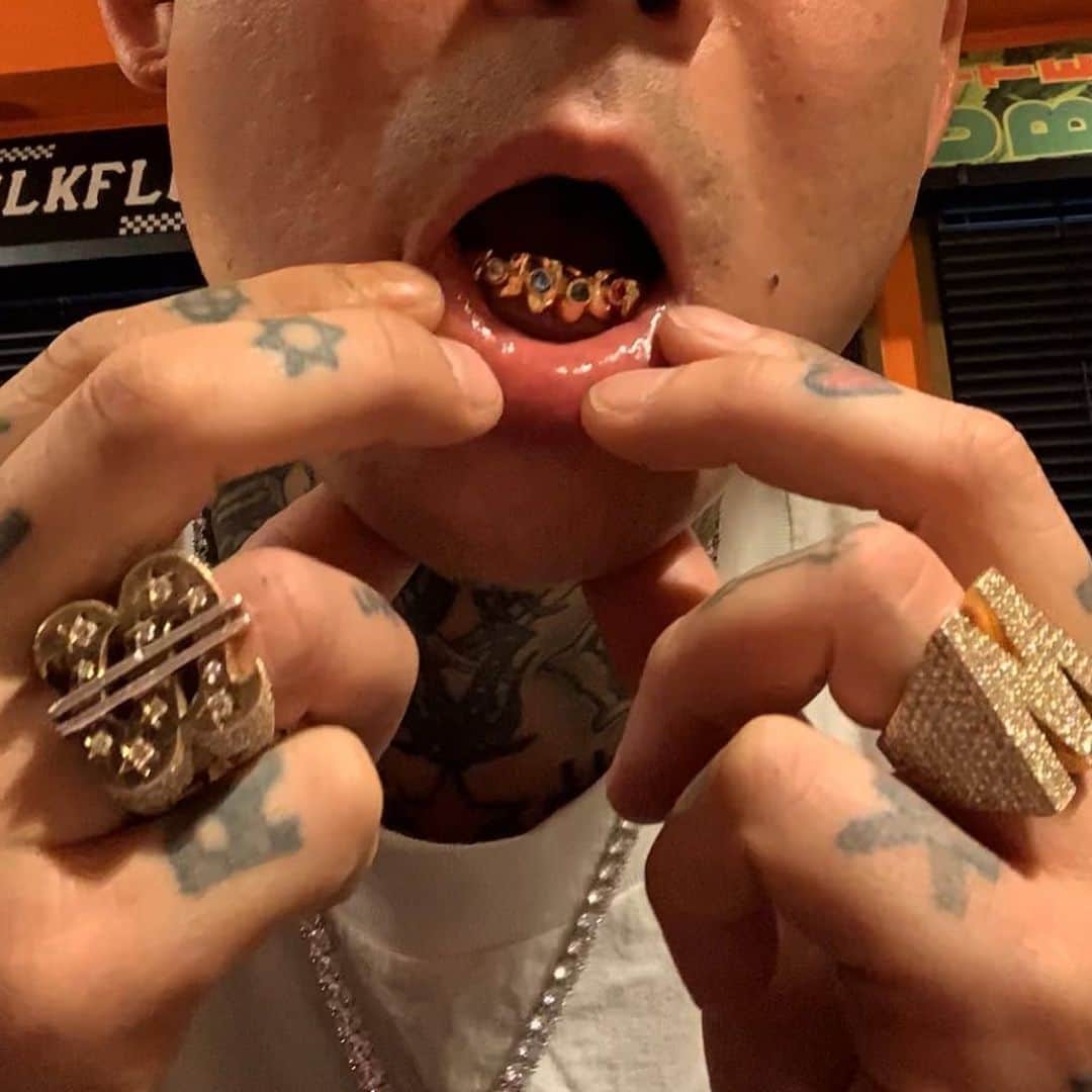 ANARCHYのインスタグラム：「NEW💎 @grillzjewelz_is_right」