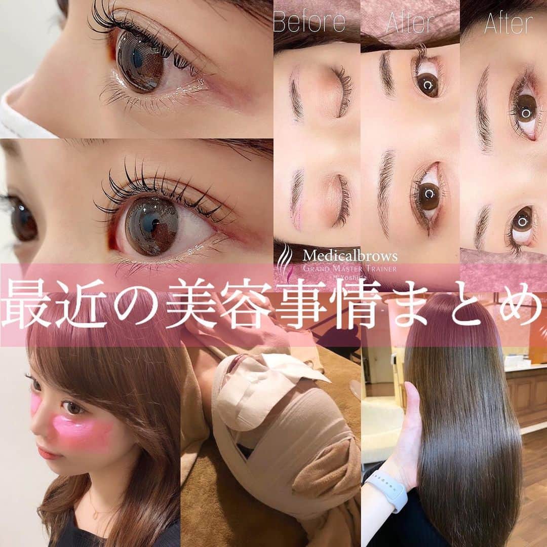 のインスタグラム：「【最近の美容事情まとめ】  🌼まつ毛パーマ 2ヶ月に1回くらい通ってる🥰 サロンは @garland_eyelash で担当はいつも @yoshino.mai さんにお願いしてます♩ 心地良くていつも爆睡しちゃう🤣 寝てる間にあっという間にきれいにくるんとカールのかかったセパレートまつ毛ができてます🥺👏  🌼脳洗浄 最近自律神経が乱れやすかったのと、「脳洗浄」と言うパワーワードにひかれて試してみたらすっごく良かったの😳 寝付きが良くなるし、気温、気圧の変化による偏頭痛も無くなったし夜ぐっすり眠れるようになったしおまけに小顔小頭にもなった！ 4回コースで選択しているので、初回と最終回のビフォーアフターは後ほどレポします🥰 私はいつも @parafuse.y.yuri.tokyo さんに施術をお願いしています✨  🌼ヘアサロン ずっと暗めの髪色だったんだけど、最近明るくしたい欲がでてきて、 @zacc_miyagawa さんにお願いしました♩ ブリーチはしないで明るめで透明感のあるカラーお願いしますっていうわがままを叶えてくれました🤣👏 想像以上の仕上がりいつも驚かされる🥺✨  🌼ぷるぷる注射 クマ、ほうれい線の施術をしていただいたんだけど、どっちも本当に本当にやってよかった😭 ずーっとコンプレックスだったのがかなり良くなって、メイクも楽になったし顔がパッと明るくなったよ😳 周りの人からも、すごく良くなったねって褒められる🥰 信頼できる @pruge_clinic の @dr_okamoto 先生が毎回担当してくれてます😌  🌼アート眉 @medicalbrows_omotesando というサロンさんの @medicalbrows_moe さんに担当していただきました🥰 もともと眉毛が細いし短くて、スッピンだとかなり印象変わるのが嫌だったんだけど、 アート眉をすることでスッピンでもちゃんと眉毛あるしメイクもかなり時短になったよ😆♥️ デザインも慎重に決めてくれるから安心♡  とこんな感じに一気にレポしてみました😌 最後まで読んでくれた方、ありがとうございます🌼  本当におすすめなので、興味がある方は是非、各メンション先に問い合わせしてみてください✨」