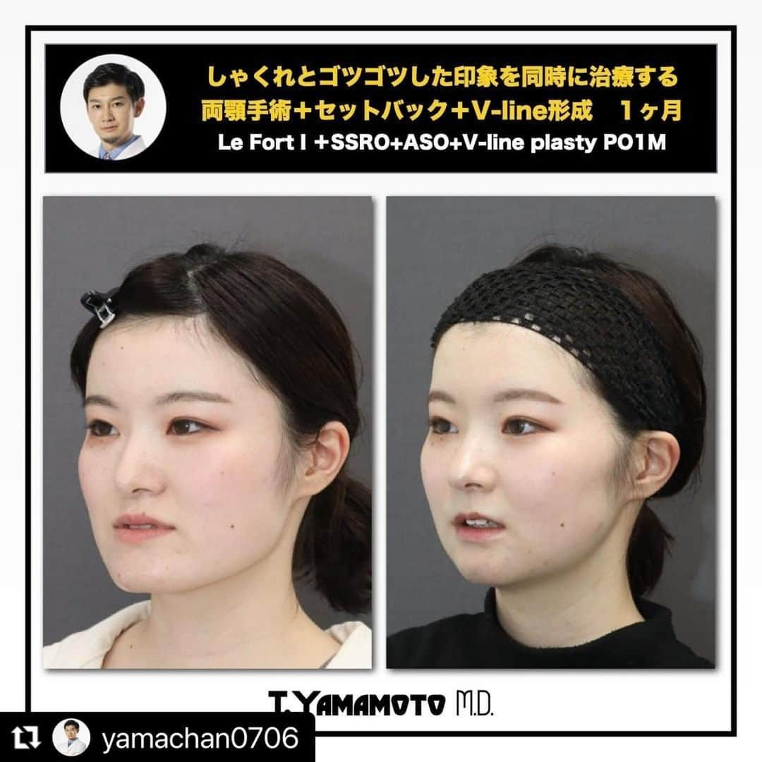 東京美容外科公式のインスタグラム