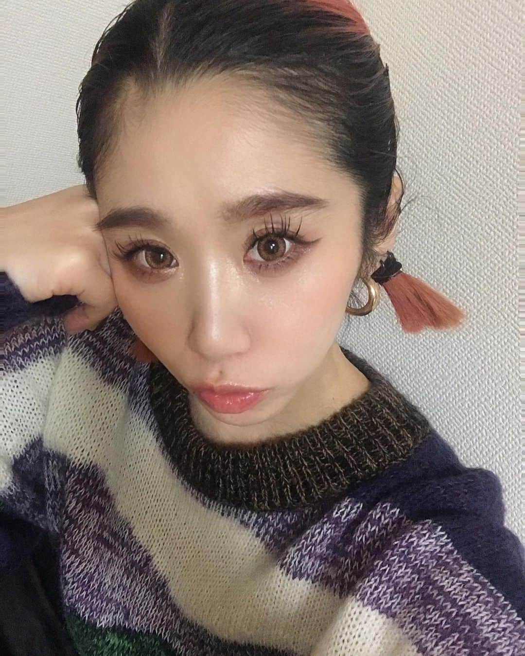 のインスタグラム：「私はいつまで👧🏻できるでしょうか…  これ以上老けたらできないよね…👧🏻  @sbeautyclinic でそろそろ メンテナンスしなくちゃね…👧🏻  顔の弛みには #アクセントウルトラV が 一番効くと思うです！  #愛子先生のアンチエイジング📝  #エスビューティークリニック」