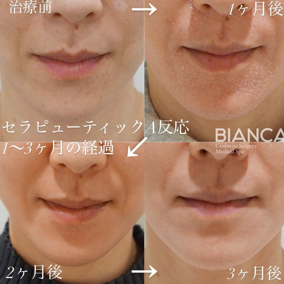 辻沢由有（BIANCA CLNIC 表参道院 院長）のインスタグラム