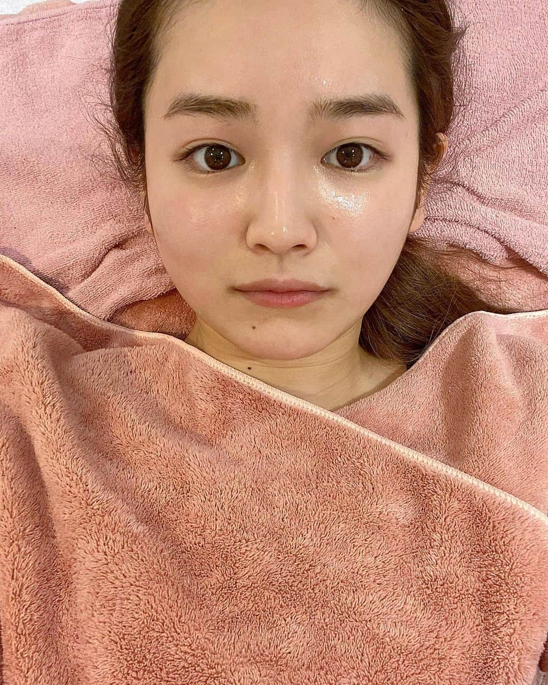 富久美玲のインスタグラム：「_ . 久々ニードレスインジェクター🧖🏻‍♀️✨ . 毎月通いたいけど難しい現実😭😭 今回はニキビが出来て肌荒れ中なので ビタミンにしてもらいました！！！ . 早くニキビ消えてくれますように← . 写真は右半顔が施術後です🤳 . いつもと違う成分を入れてもちゃんと シュッて引き上がってくれて良き💡 . 前回、口角上げて撮って分かりにくい というコメント頂いたので真顔ですw .」