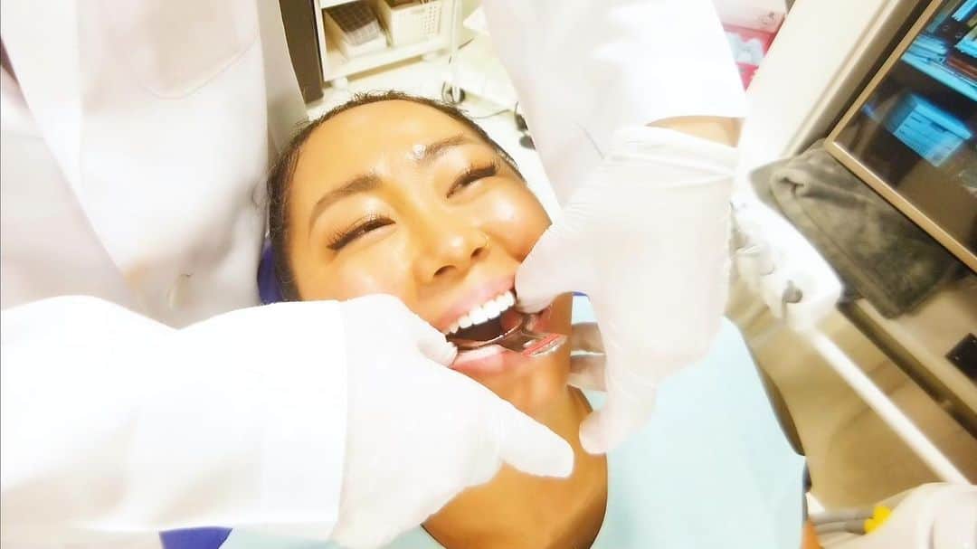 ルナのインスタグラム：「前回に続き「Y's Dental Cure（ワイズデンタルキュア）」三井院長先生の㊙️オススメの最新ホームホワイトニングにいよいよ初挑戦🦷. こんな方法で良かったなんて🤯. 最新のマウスピースに感激しちゃった😳. 是非ご覧くださいまーせ！！！. #ホワイトニング  #ysdentalcure  #デンタルケア」