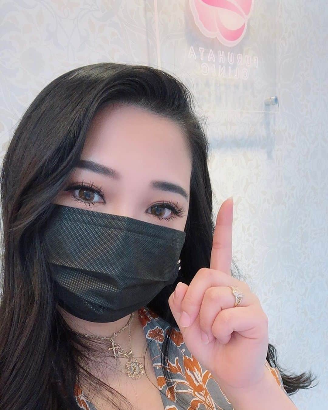 amiのインスタグラム：「. . . 人生初のシンデレラハイフを受けて来たよ！  動画もアップしたんだけど 施術はあっという間で 痛みが苦手な人にオススメなんだそう！ . before afterも写真載せてるよ！😳  私は施術直後でも効果が感じられた気がする。 じわじわと時間をかけて効果がより感じられるみたいよ！ 今から凄く楽しみ！  . @furuhifu  @cinderellahifu  先生ありがとうございました💫  . シンデレラハイフは日本で導入されている HIFUマシン（ULTRAcel Q+)による施術です！  ハイフは医療行為なのでクリニックで受けましょう🏥 　 https://cinderellahifu.com/ . . . #シンデレラハイフ  #PR」