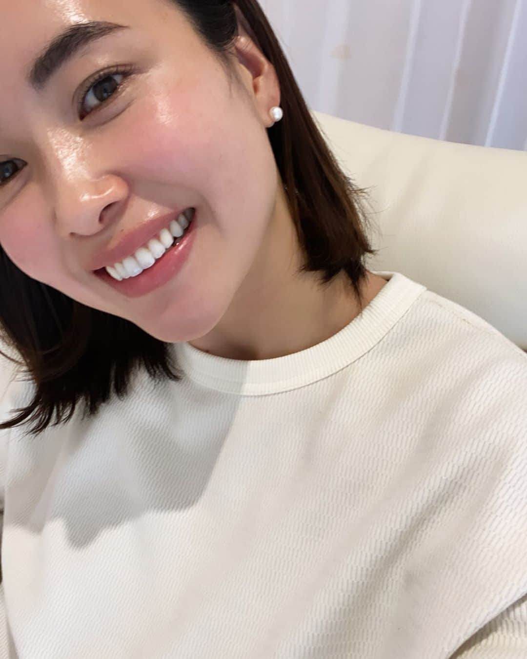 IIDA YURIさんのインスタグラム写真 - (IIDA YURIInstagram)「この間はホワイトニングへ🦷 . @smileywhitening  . 2カ月ぶりのメンテナンス🦷  白くするだけじゃなくて歯周病予防としても定期的に通っています。 マスク生活で雑菌が増えた口の中もリセットしてくれて歯がツルツルになりますよ。  ホームホワイトニングや他の歯医者さんでのホワイトニングとは全く別物で、エリナ先生のホワイトニングは本当おすすめします😌 　 . #ホワイトニング#スマイリー#wクリニック#wclinic#大阪#心斎橋#歯のホワイトニング」2月22日 11時50分 - yurima_ma