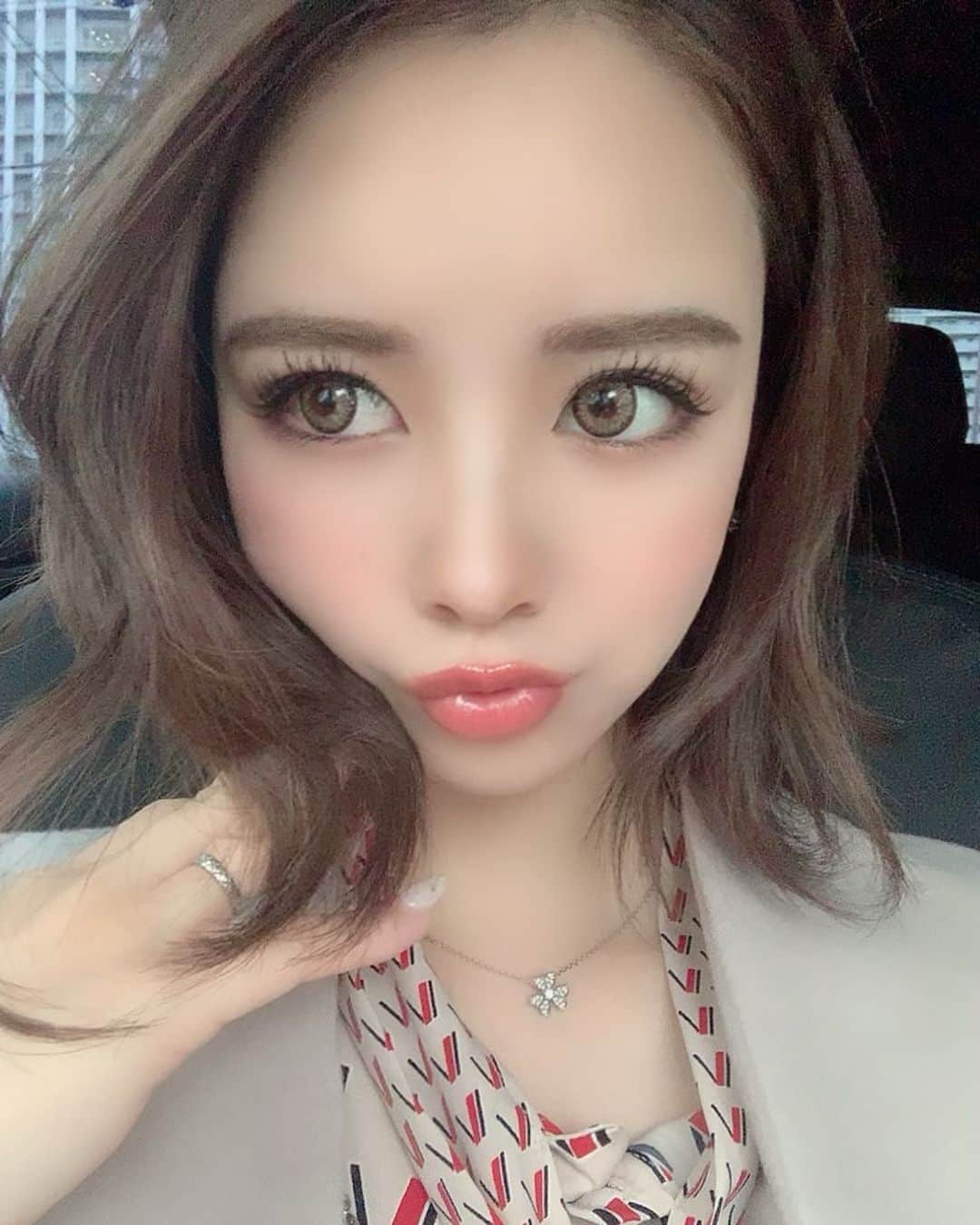 姫奈のインスタグラム：「. . @clinique.osakashinsaibashi さんで 顎下のハイフしてもらってきました🥺💓 ここは色んな機械のハイフあって 強さとか持ちとか 説明してくれるから超オススメ♡ 私はダブロゴールドで当ててもらいました🔥 ハイフはここが一番信用してる😌🤍 . . . #大阪クリニック #ハイフ #クリニーク大阪心斎橋」