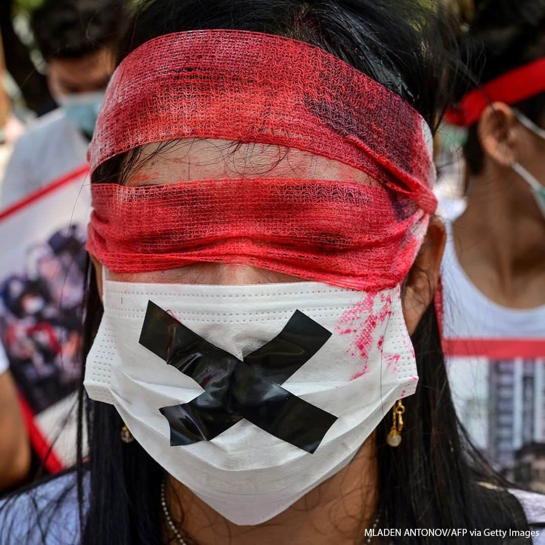 ABC Newsさんのインスタグラム写真 - (ABC NewsInstagram)「A protester wears a facemask and blindfold as Myanmar migrants in Thailand demonstrate against the military coup in their home country. #myanmar #protest」2月22日 23時00分 - abcnews