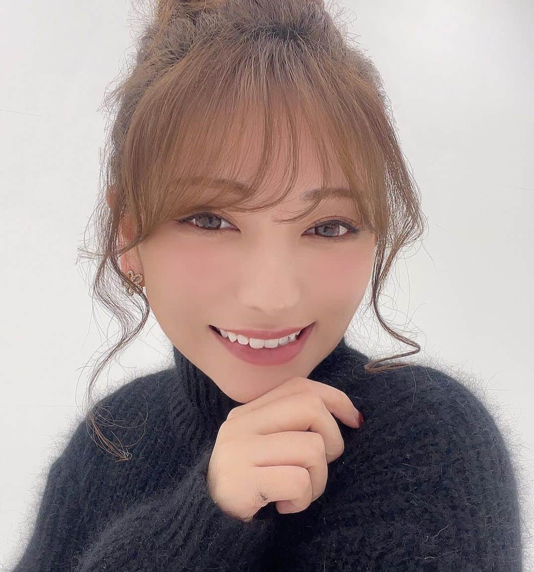 のインスタグラム：「このまえ新宿TAクリニックに行ってきました👨‍⚕️そのお陰で現在肌がぴかぴか  ㅤㅤㅤㅤㅤㅤㅤㅤㅤㅤㅤㅤㅤ 私は肌の悩みは市販の高いクリームを塗るよりも、美容皮膚科に行って施術した方が絶対いいと思ってます✨ ㅤㅤㅤㅤㅤㅤㅤㅤㅤㅤㅤㅤㅤ  ㅤㅤㅤㅤㅤㅤㅤㅤㅤㅤㅤㅤㅤ 私は今回プラズマシャワーとサリチル酸ピーリングをして肌の毛穴の掃除や古い角質除去をしました！  どっちも全然痛くないのに触ったあと肌がもちもちするよ🥰本当おすすめ！  ㅤㅤㅤㅤㅤㅤㅤㅤㅤㅤㅤㅤㅤ  ㅤㅤㅤㅤㅤㅤㅤㅤㅤㅤㅤㅤㅤ 担当してくれた先生は @dr_shotacchy  めちゃめちゃ丁寧で優しい先生です👨‍🏫💕  ㅤㅤㅤㅤㅤㅤㅤㅤㅤㅤㅤㅤㅤ  これからも定期的に通う🦋  ㅤㅤㅤㅤㅤㅤㅤㅤㅤㅤㅤㅤㅤ  ㅤㅤㅤㅤㅤㅤㅤㅤㅤㅤㅤㅤㅤ  #新宿TAクリニック#TAクリニック #新宿#新宿三丁目#美容#美容皮膚科#美容外科#神尾美月」