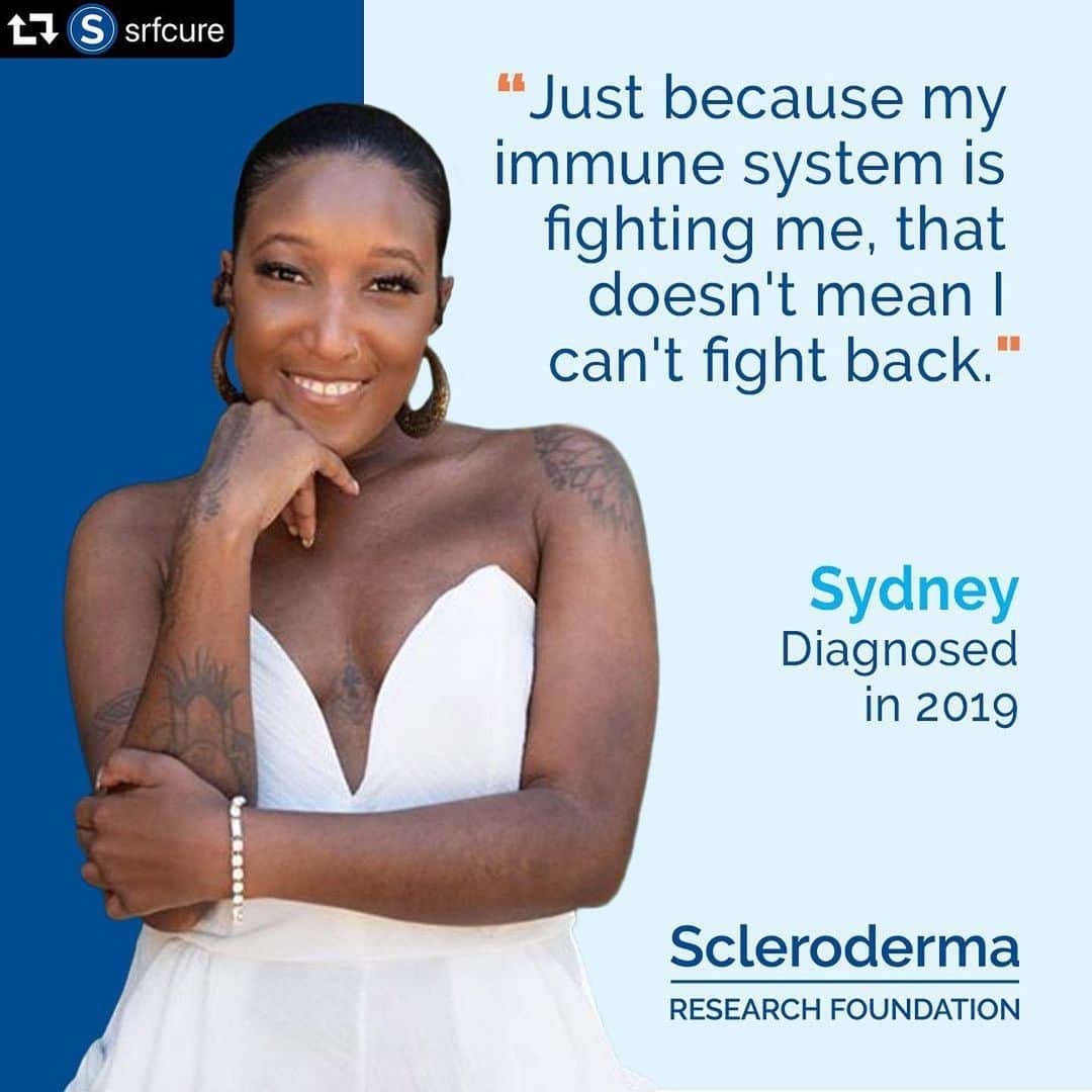ボブ・サゲットさんのインスタグラム写真 - (ボブ・サゲットInstagram)「Sydney is such an amazing woman. So proud I’m a Board Member of the Scleroderma Research Foundation to be with her as she “Fights Back” against this often debilitating disease.  repost @srfcure ・・・ February is Black History Month, and Sydney @sydneysnoble is spreading awareness about how scleroderma affected her. "I find it extremely important to share my story this month,“ she says, because of the “lack of awareness about scleroderma plus the higher incidence of this disease within the Black community.”  Like many patients, Sydney made difficult changes to her life when she was diagnosed a little over a year ago. “Prior to being diagnosed I was a professional dancer, photographer, and full-time business owner who juggled all three hustles simultaneously,” she says. Amidst the loss of these important parts of her life, Sydney’s grateful that she was able to be diagnosed quickly, but she realizes that’s not always true for others. "Scleroderma compared to other autoimmune diseases is so unknown within the nation today,” Sydney explains.  It’s about more than just awareness for Sydney - she notes that research is critical. “Finding a cure is of the utmost importance,” she says, but also “finding treatment plans in the immediate future that are as safe and healthy for the body as possible.”   In the meantime, Sydney’s positive mindset has kept her strong in the face of these challenges. “Although my life path has been forever changed I was able to adapt and continue on with running my candle business, The Noble Brand,” she says. “Just because my immune system is fighting me, that doesn't mean I can't fight back."  #BlackHistoryMonth #TheNobleBrand #sclerodermaresearch #srfcure #sclerodermaresearchfoundation #scleroderma #morethanscleroderma #sclerodermafreeworld #research #raredisease #autoimmune #ResearchistheKey」2月25日 2時57分 - bobsaget