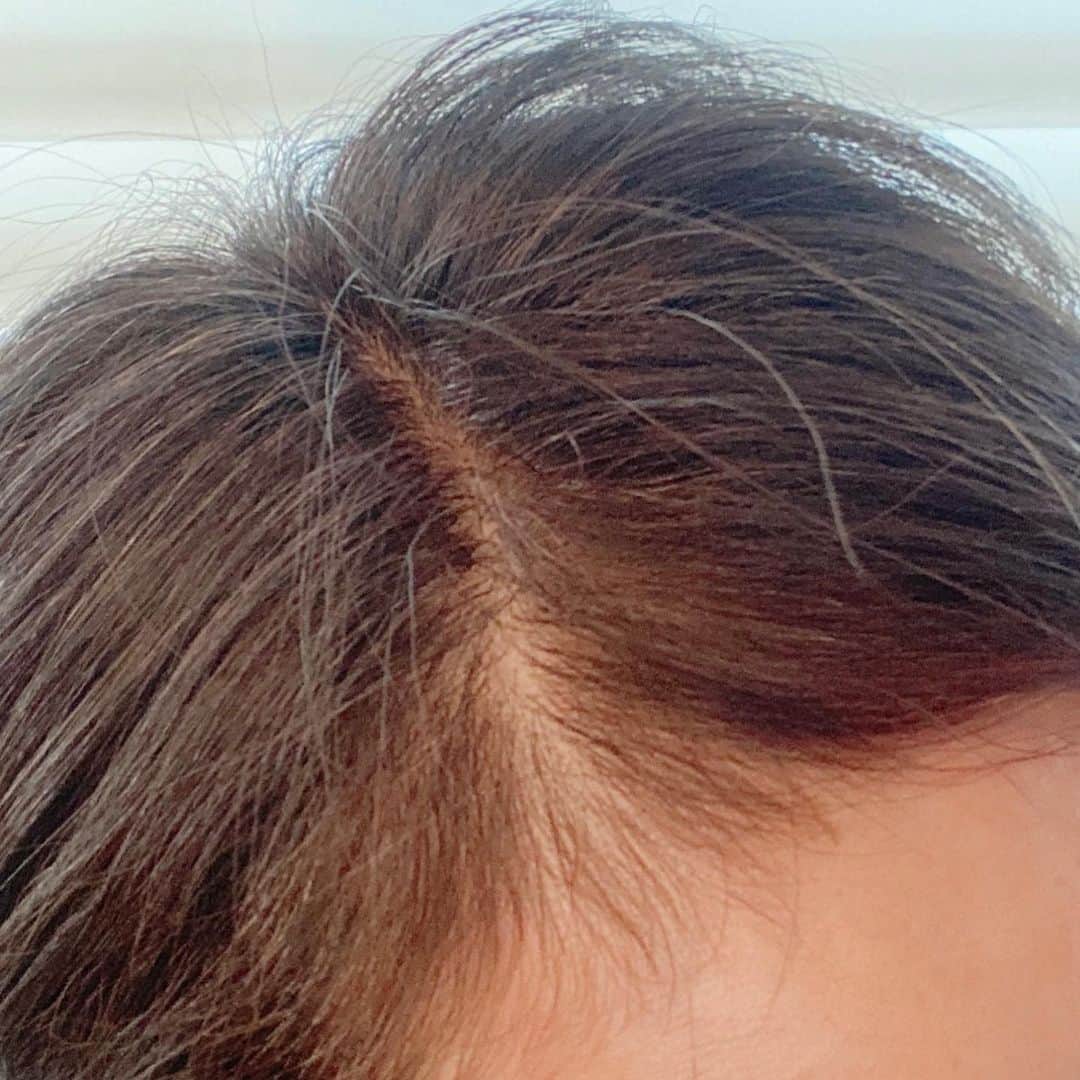 金子エミさんのインスタグラム写真 - (金子エミInstagram)「【情報】さあ！今日いよいよ 👩‍🦳白髪を直ぐに黒髪🧒🏻に簡単にカバーできる ヘアファンデーションが販売されます❗️  📺フジテレビ AM11:00〜予定 ノンストップ 「いいものプレミアム」 @iimono_premium_official  出演させて頂きます。  ホワイトカラーを直ぐにカバーできる👩‍🦳✨ ヘアファンデーション🤎モンローブラウンが お買い得な価格で発売❗️  🔷ブラシカットが生え際にピタリ❗️ 🔷極度カラーでない限り、日本人の髪色にピタリ❗️ 🔷鏡が🪞大きくて見やすい❗️  実は私…３分の2は髪が白いのです🦳✨ 小まめにカラーすると髪にツヤがなくなり 髪が傷むので、こちらのモンローブラウン に頼りヘアカラーは月に１回にしています。  顔まわりの生え際は、直ぐキラン🤍✨ って白髪は光るので お守りのようにモンローブラウンを 持ち歩いています👩‍🦳💕  特に今は美容室にも行きにくいので モンローブラウン🤎本当に大活躍しています。  今日もこちらに頼り… まるで黒髪の人のように 行ってきます🧒🏻✨  #ヘアファンデーション #いいものプレミアム #ebis #エビス化粧品 #白髪ケア」2月25日 7時37分 - emikaneko1114