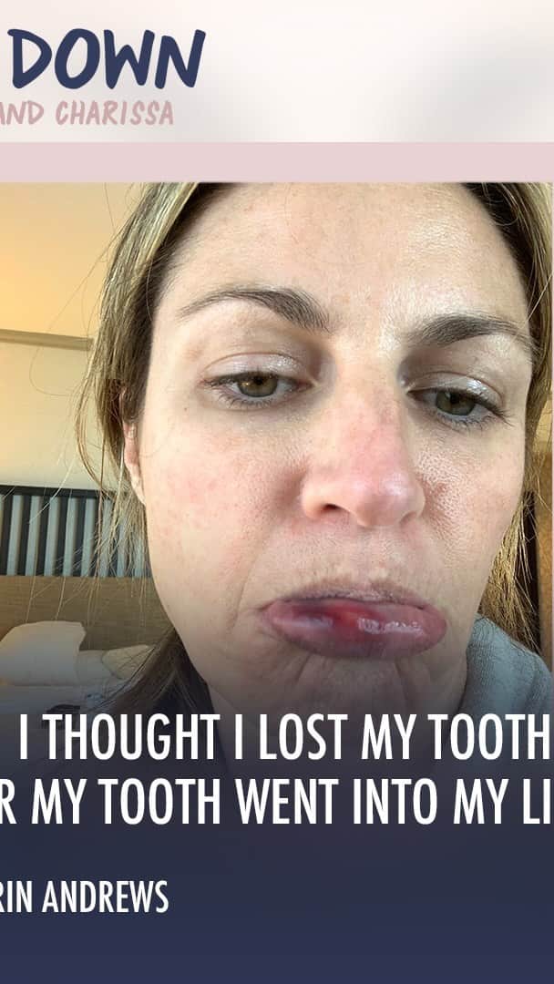 エリン・アンドリューズのインスタグラム：「Well here’s one I haven’t shared yet.   How did I prep for the 1st matchup between Brady & Rodgers this season? It had to do with A TON of ice and Arnica!   Before the game, my dog Howie head butted me and my lip exploded. #goldenretriever owners you can relate!   Episode 2 if the @calmdownpodcast is out now. Link is in bio.  #Gamer #Ouch #Howie」
