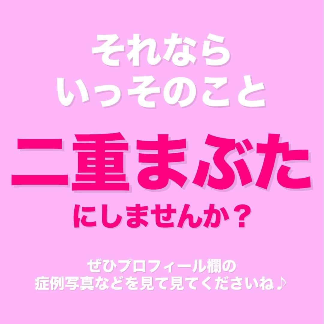 湘南美容外科 柏院さんのインスタグラム写真 - (湘南美容外科 柏院Instagram)「こんにちは！ 湘南美容クリニック柏院です！  今回は一重まぶたで悩んでいる方や 二重の左右差などで悩んでいる方！ アイテープを毎日使っている人に向けてのお話です！  詳細は画像をご覧ください！ 「塵も積もれば山となる」とはこのことですね＾＾；  🌸湘南美容クリニック柏院🌸 JR常磐線柏駅 南口より徒歩3分　Day Oneタワー 2階 ☎️0120-489-750 診療時間　10:00～19:00  ＝＝＝＝＝＝＝＝＝＝＝＝＝ #湘南美容 #湘南美容クリニック  #湘南美容外科  #湘南美容クリニック柏院  #柏  #柏の美容クリニック #整形の裏側  #美容整形 #医療美容 #アイシャドウ  #アイテープ  #メイク  #時短 #二重になりたい  #二重テープ  #二重にする方法  #二重切開  #埋没二重 #切開二重 #湘南二重 #湘南二重術  #湘南美容外科クリニック  #二重好き  #プチ整形しました  #プチ整形 #時間の無駄 #有意義な時間 #有意義に過ごそう  #有意義な休日  #損」2月26日 16時31分 - sbc_kashiwa