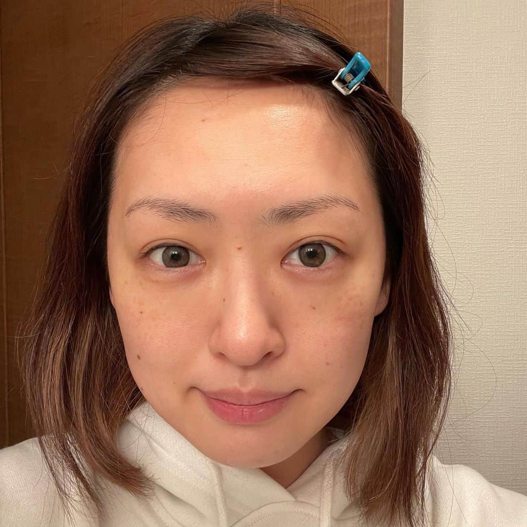 脇田唯のインスタグラム：「☺ お目よごし、すみません Beforeを撮ってないので 分かりにくいかもしれません。  絶世の美女でもないので これで堂々と写真貼るのも 伝わりにくいかも知れませんが💦  34歳のスッピンとしては、 施術してもらって、 頬のほうれい線とか、 顔のたるみとか、 目の開きとか、 なかなかに向上したと思います。  これ、iPhoneの純正カメラ 加工無しです。  シミとかはまぁ、 年齢通りそれなりにありますが、 肌のトーンも少し上がり、 血色も良くなりました。  私の中学の同級生が、 ホットペッパーで予約受けてます。 男性ですが話しやすい人です。  【小顔・睡眠改善・リラックス整体】サロン テセラ https://beauty.hotpepper.jp/kr/slnH000443355/?vos=cpahpbprosmaf131118005  ★ホットペッパービューティーのアプリダウンロードはこちら↓ https://beauty.hotpepper.jp/doc/sp/  #札幌エステ #札幌サロン #整体 #小顔 #睡眠改善 #リフトアップ」