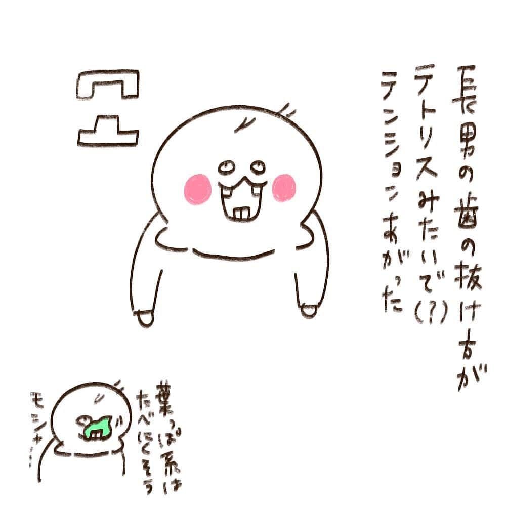 やまもとりえのインスタグラム：「テトリス歯」