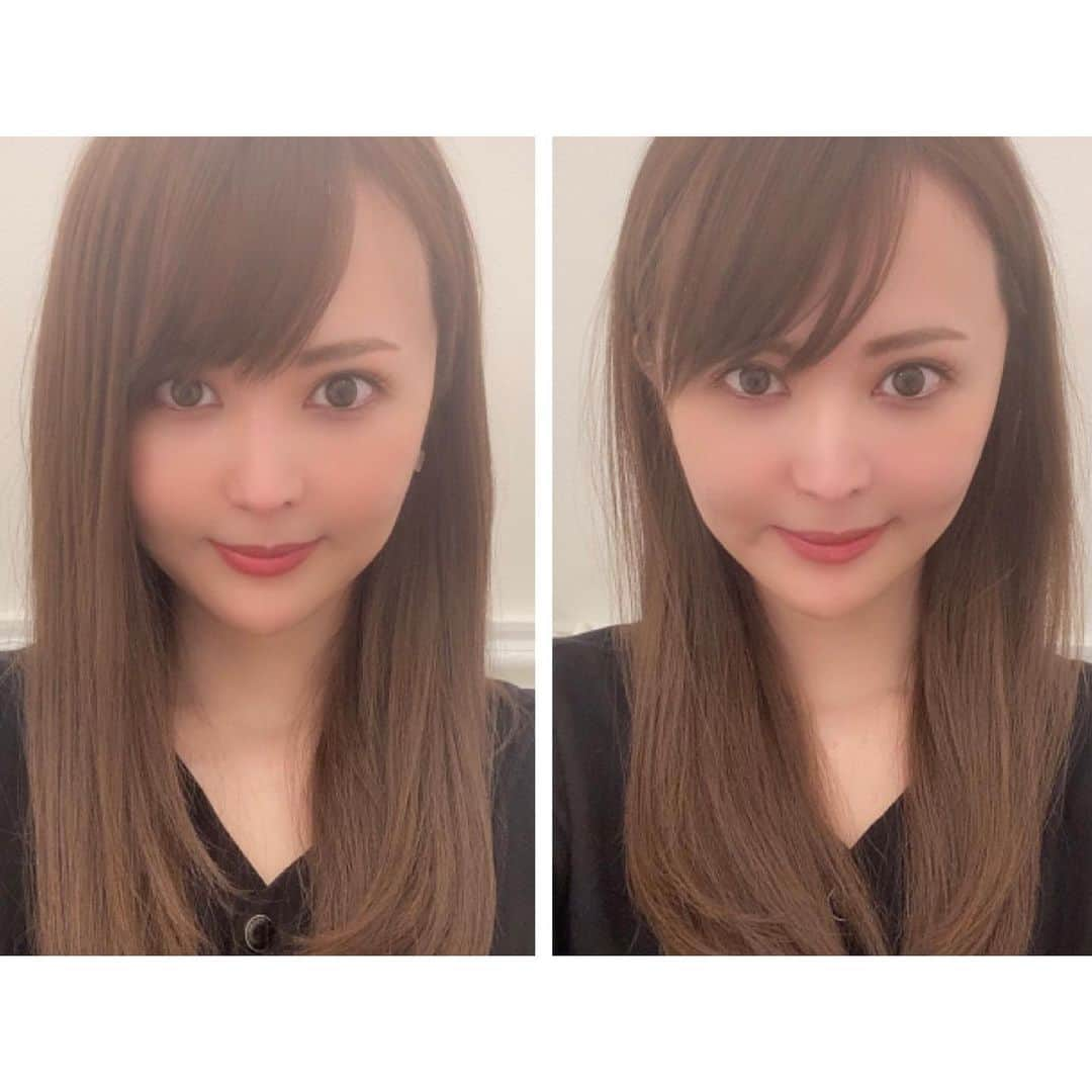 望月美穂さんのインスタグラム写真 - (望月美穂Instagram)「﻿ ﻿ #aclinicで#小松塁 先生 @dr.komatsu_rui に Aスレッドをしてもらいました♡﻿ ﻿ たるみが気になってきたので久しぶりにメンテナンス✨✨﻿ ﻿ 入れた直後から腫れないし、顔が一回り小さくなりました！﻿ たるみも引き上がってすっきり💓💓﻿ もったりした感じがなくなりました✨﻿ もうAスレッドなしでは生きていけないー🥺💓💓﻿ ﻿ 先生のカウンセリングは丁寧でとても優しいので安心してお任せできます💭﻿ ﻿ 次はまたアイドルチークやりたいなぁ♡﻿ ﻿ ﻿ ﻿ #aスレッド #糸リフト #aclinic #aclinic銀座 #aclinic横浜 #aクリニック #美容 #小顔 #美肌 #リフトアップ #美容外科 #美容皮膚科 #美容クリニック」3月28日 21時19分 - miho_nyan1018