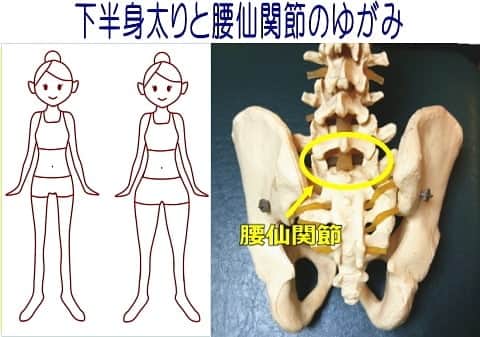 中目黒整体レメディオ 院長　渡邉潤一のインスタグラム：「多くの下半身太りの方に共通するゆがみがあります。  それは、腰仙（ようせん）関節という部分のゆがみです。  ここでは、腰仙関節の役割となぜ下半身太りに影響するのかについてお話ししていきます。  まず、腰仙関節とは、腰椎の一番下の骨と仙骨がつくる関節（画像の丸の部分）で、この関節には非常に重要な役割があります。 それは、上半身から下半身にかかる重さを約70～80％近くカットするという役割です。  しかし、下半身太りの方はこの関節がゆがみ、バランスが崩れているため、下半身にかかる重さが正常な状態に比べて増えてしまいます。  その負担は、まずお尻まわりの筋肉にかかり、そして太ももにかかります。特に太ももでは外側の筋肉に負担がかかります。  筋肉が硬くなることで筋肉は太くなり、また、代謝は落ちるのでお尻まわりや太ももに脂肪が付きやすく、結果、下半身全体が太くなっていきます。  腰仙関節のゆがみによって引き起こされる状態を、もう少し分かりやすく例えると、普段から上半身に5キロ位の重りを着けて生活しているような感じです。  この状態では、常に脚に負担がかかるのは当然です。 逆を言えば、この重りが無くなれば、脚への負担が減ると言うことです。  腰仙関節をなおすことは、下半身痩せに非常に重要です。  なかなか脚が細くならないと感じている方は、この腰仙関節がゆがみ、バランスが崩れているのかも知れません。 . . 腰仙関節を調整するためには、腰仙関節に対してダイレクトにアプローチする必要があります。  しかし、残念ながら腰仙関節はご自身でアプローチする事が出来ない部分です。 あくまでも関節に対するアプローチですので、運動や骨盤体操などでは、この腰仙関節には直接対応出来ないというのが、正直なところです。  この部分をなおすためには、この事をきちんと理解している整体師による的確な施術が必要になります。  出来れば、毎日の運動や体操に合わせて、整体などで定期的にゆがみを調整してもらうことおすすめします。 . . . この他の下半身太りを引き起こす骨盤のゆがみ、矯正ストレッチについては  プロフィールのブログURLから ↓ テーマ別 ↓ ・骨盤 反り腰 原因 矯正方法 治し方 を、ご覧ください。 . . . 💮施術のご案内 中目黒整体レメディオ：骨盤・美脚コース ご予約はHPの予約フォームか、お電話（0357735977）にてご連絡ください。  HPへのリンクは、プロフィール欄の【HP・予約】またはブログ記事下にあります。 . . . #大転子 #大転子矯正 #o脚矯正 #x脚矯正 #膝下o脚 #XO脚 #骨格矯正 #骨盤矯正 #産後骨盤矯正 #下半身太り #下半身痩せ #太もも痩せ #ふくらはぎ痩せ #反り膝  #反り腰 #骨盤の歪み #整体 #中目黒 #レメディオ #姿勢矯正 #中目黒整体レメディオ #整体サロン」