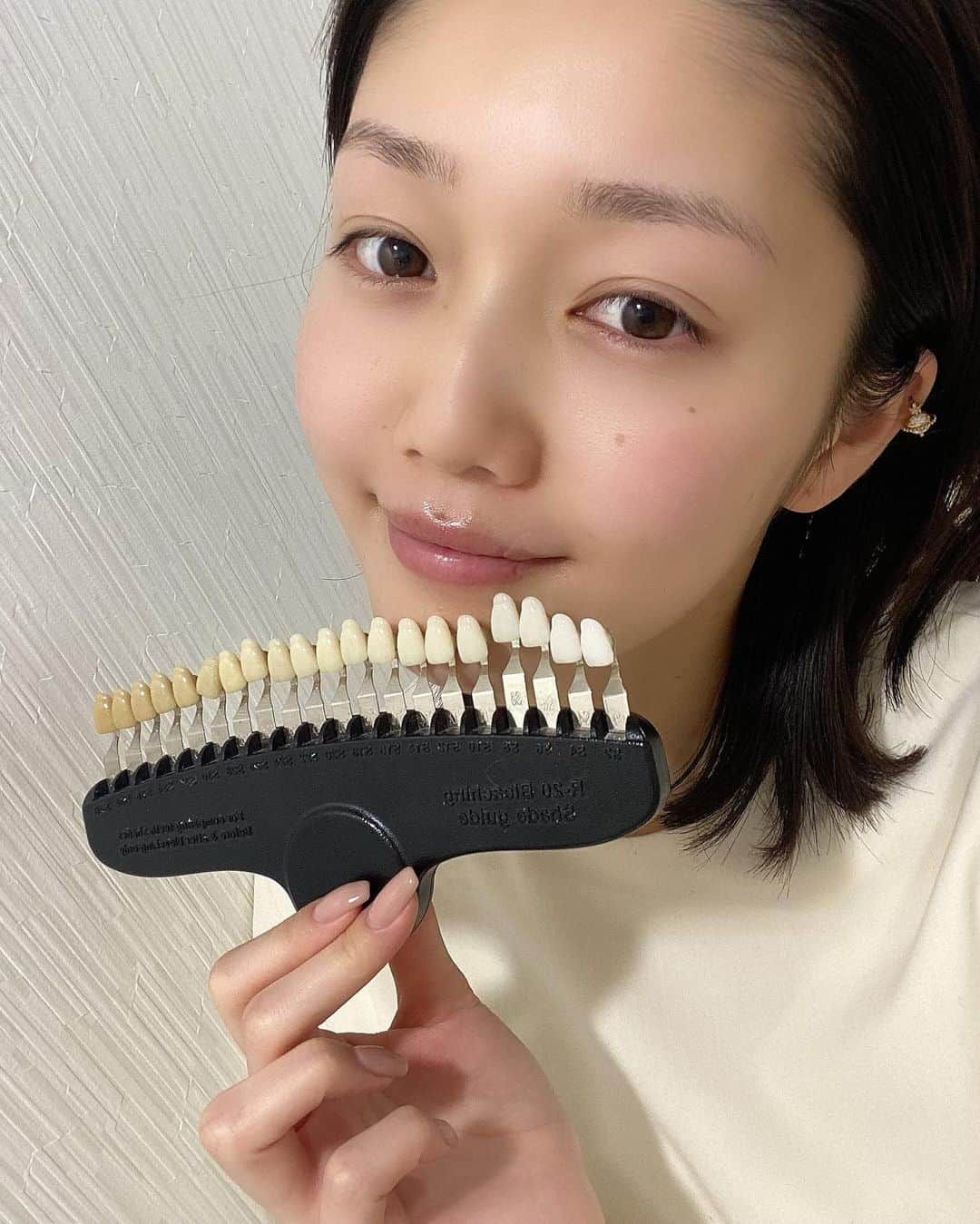 松川菜々花さんのインスタグラム写真 - (松川菜々花Instagram)「・ 昨日の美容デイ最後はホワイトニングへ🦷 ここのホワイトニングはセルフでやるんだけど簡単だし、終わった後飲み食い気にせずで横になりながらできるし短時間でおわって一回だけでも効果得られた✨  口周り多少、終わった後の跡があるけど気にならない？笑 スッピンで失礼しやす🙇‍♀️  @light_beauty_ebisu @kimono_no_jun  ライトビューティーグループホームページ https://light-beauty.tokyo/  ライトビューティー恵比寿ホットペーパービューティー https://beauty.hotpepper.jp/kr/slnH000496838/  #ホワイトニング #lightbeauty恵比寿 #lightbeauty  #whitening #ホワイトニングサロン #白い歯 #綺麗な歯 #歯のホワイトニング #selfwhitening #デンタルエステ #セルフホワイトニング #審美歯科 #おすすめエステ #恵比寿ホワイトニング #恵比寿エステ #ホワイトニング恵比寿 #ホワイトニング東京 #恵比寿 #都内おすすめスポット #オフィスホワイトニング #dental #dentalwhitening #無痛ホワイトニング #セラミック #ホームホワイトニング #インビザライン #歯列矯正」3月16日 18時50分 - matsukawa__nanaka