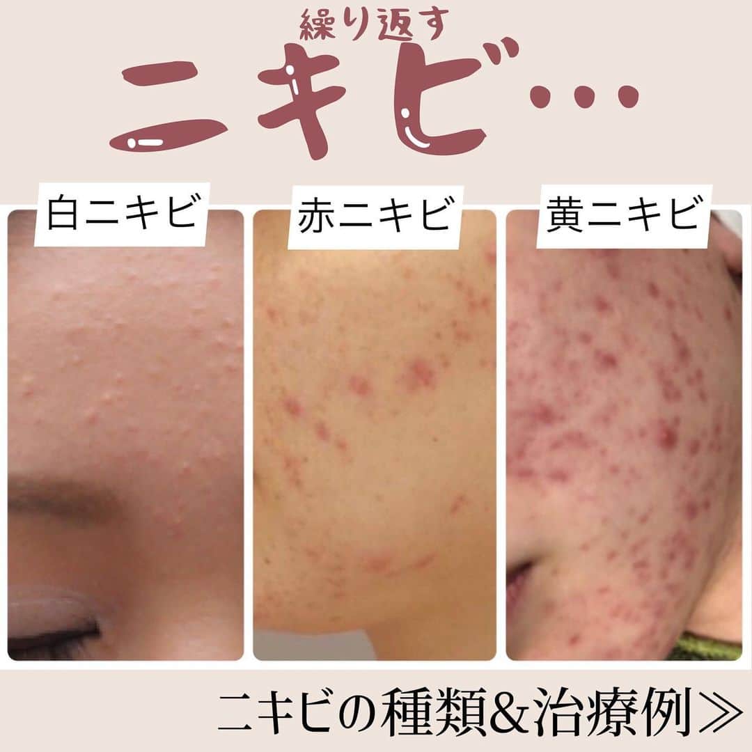 オラクル美容皮膚科東京新宿院のインスタグラム