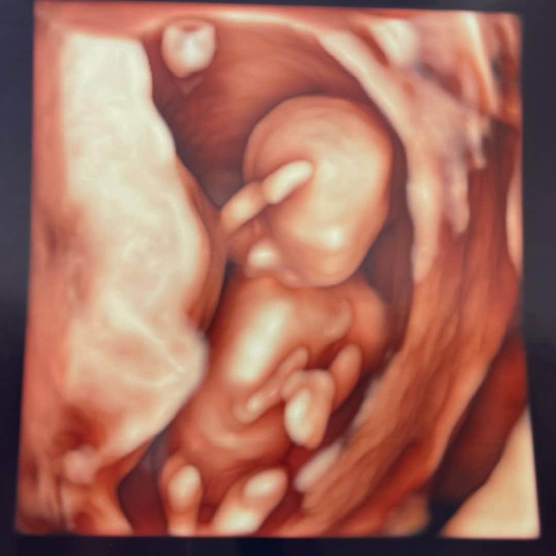 セーラのインスタグラム：「2人目妊娠中🤰💕  お腹の中で敬礼してるぅ〜😂  #妊娠中　#妊婦　#4Dエコー」