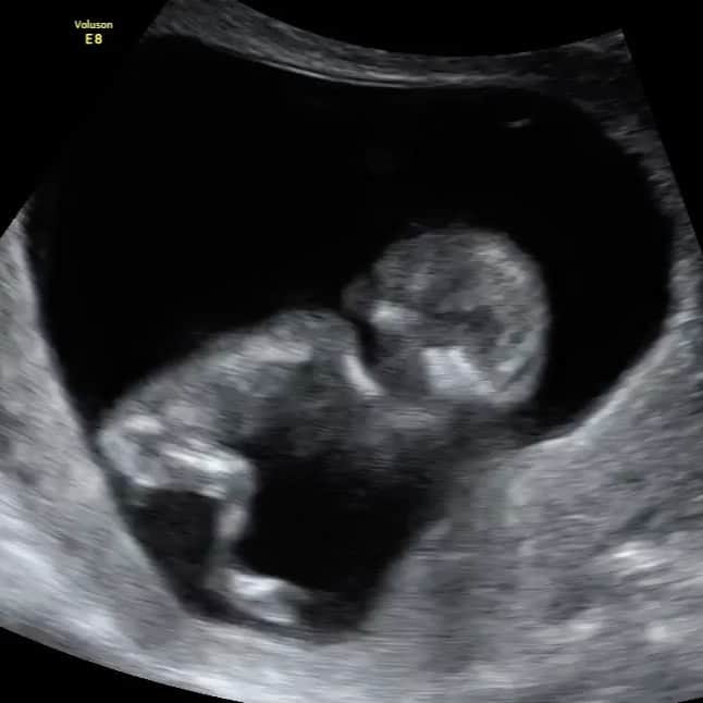 ジョージア・フォウラーのインスタグラム：「Our little bouncing bean 🦵🏽 🤍」