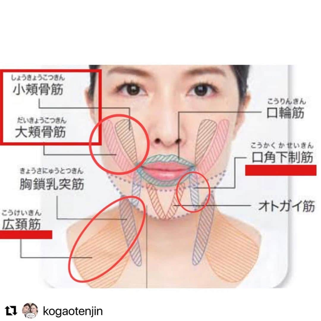 小顔科学研究所 さんのインスタグラム写真 - (小顔科学研究所 Instagram)「@kogaotenjin with  ・・・ こんにちは😃  小顔科学研究所〖 @kogaokagaku 〗 もちだです🤗✨ . . まだまだ続くマスク生活🙇‍♂️ お客様の中でもほうれい線や マリオネットラインが濃くなった等々の お客様も増えました😢 . 今回はマリオネットラインの事についてです‼️ . 原因と改善法を知ってるだけでも 意識するので変わりますよ☺️✨ .  初回美容鍼は税込5,500円で施術可能です！  . さらに！！ 大人気の圧倒的小顔矯正🌟﻿ モニターキャンペーン実施中です🎶﻿ 施術のビフォーアフター掲載可能な方✨﻿ ﻿ 10万円キャッシュバック中です！﻿ ※詳細はトップからホームページを﻿ ご覧下さいませ✨﻿ ﻿ ﻿ ★必須条件﻿ ・お客様の声アンケート﻿ ・ホワイトボードでの施術後の感想を持ったお写真﻿ ・施術前後の写真変化、数値変化を当院の﻿ 　SNS・ホームページで使用させて頂くこと﻿ ﻿ 上記3点必須条件です。﻿ ﻿ 変化の程やお値段などでお悩み中の方はぜひ﻿ 無料カウンセリングのみのご予約も可能です！﻿ ﻿ ﻿ 詳しくはトップページ (@kogaokagaku)﻿ リンクの公式ホームページから﻿ お問い合わせ下さいませ。﻿  ﻿ ﻿ ﻿ ﻿ ﻿ #小顔 #小顔矯正 #骨盤矯正﻿ #痛くない小顔矯正 ﻿ #小顔効果 #小顔はつくれる ﻿ #芸能人御用達 #美容 ﻿ #小顔科学研究所﻿ #小顔矯正サロン #小顔サロン﻿ #小顔施術 #小顔女子﻿ #表参道小顔矯正﻿ #小顔矯正表参道﻿ #心斎橋小顔矯正﻿ #小顔矯正心斎橋﻿ #名古屋小顔矯正﻿ #小顔矯正名古屋﻿ #博多小顔矯正﻿ #小顔矯正博多﻿ #小顔矯正博多﻿ #ボトックス注射﻿ #美容外科クリニック﻿ #たるみ取り﻿ #むくみ取り﻿ #歪み矯正﻿ #モニター募集﻿ #フェイシャルマッサージ﻿ #キャッシュバックキャンペーン﻿ ＃求人募集　#鍼灸師募集中」4月19日 15時37分 - kogaokagaku