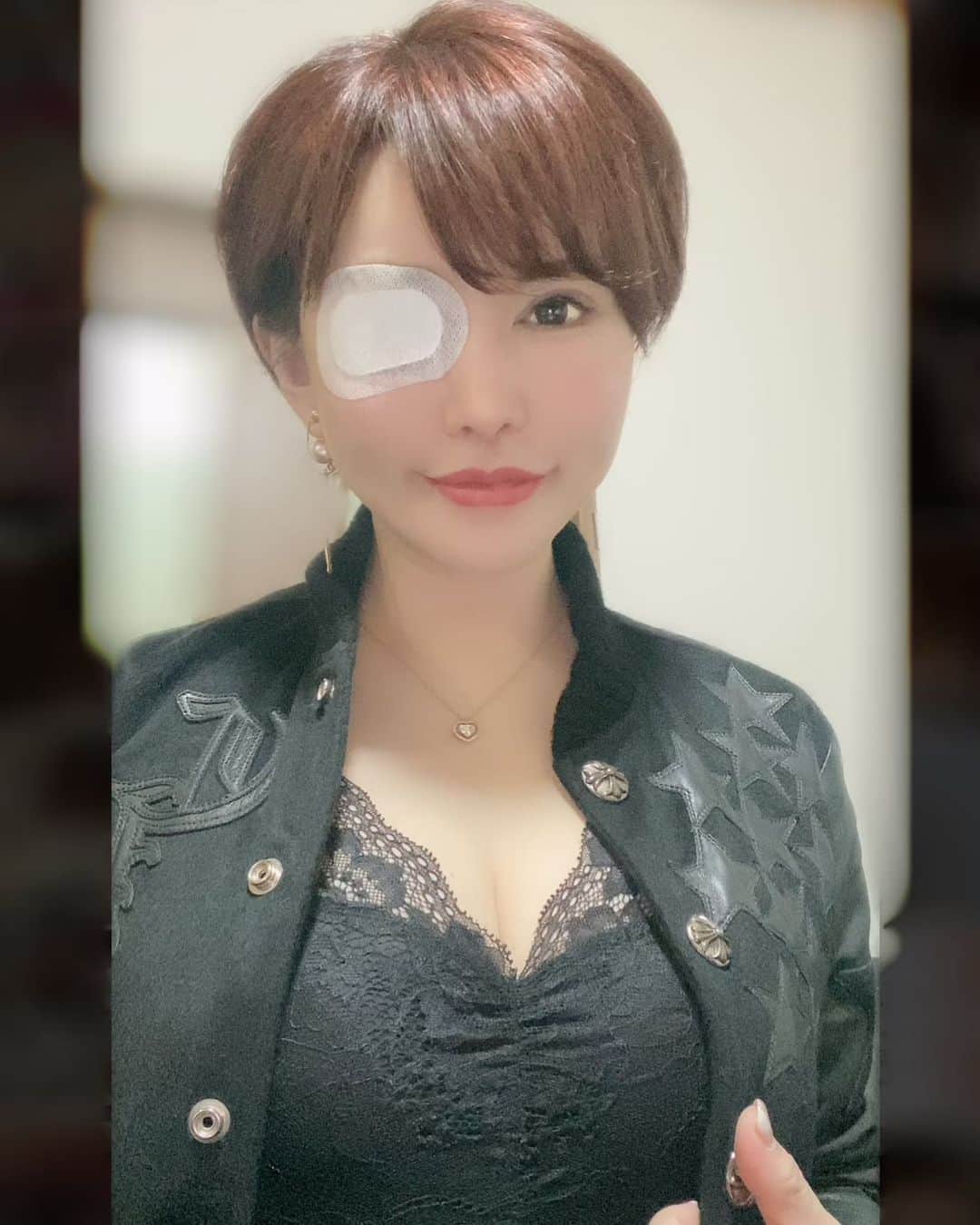 里美ゆりあのインスタグラム：「眼帯フェチさんいるかな？  昨日霰粒腫(さんりゅうしゅ)の左目を2回目の再手術をして腫れてますが右目は1度の手術と点眼薬で治まると良いな。  癖になる病気みたいだから右目も芯を出したい気持ちではある😒  せっかく楽しみにしていた色々な仕事をキャンセルせざるを得なかったのがとても残念😭  皆さんの励ましの暖かいメッセージありがとうございます❤  治ったら沢山働くぞー☺️☺️  #霰粒腫 #目 #眼帯」