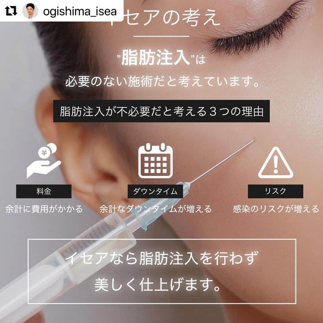 東京イセアクリニックさんのインスタグラム写真 - (東京イセアクリニックInstagram)「＼下眼瞼脱脂術／  執刀医▪️荻島信也 @ogishima_isea   Repost @ogishima_isea with @make_repost ・・・ #下眼瞼脱脂術#目の下のたるみ取り（脂肪）﻿ Before・・・術前﻿ After ・・・1か月後 ﻿  \\イセアの考え// 脂肪注入を行わず美しく仕上げること  -脂肪注入が不必要だと考える3つの理由- ①費用が余計にかかってしまう 脂肪注入の費用がプラスされ患者様の金銭的な負担が増えてしまいます。  ➁無駄なダウンタイムがかかってしまう 注入する脂肪を採取する太ももやお尻などに余計なダウンタイムを生じてしまいます。  ➂感染のリスクなどの可能性が上がってしまう 定着しなかった脂肪が壊死し、しこりになってしまいます。また感染症のリスクも増えてしまいます。 ﻿ 【施術の詳細】﻿ 🕐手術時間 ・・・約1時間﻿ 👁ダウンタイム・・・約1週間﻿ 📆完成まで ・・・約3か月﻿ 🏥術後の通院　・・・2回（1ヶ月検診、3ヶ月検診）﻿ ﻿ ﻿ 【下眼瞼脱脂術とは？】﻿ 目の結膜部分（アッカンベーをしたときに出る赤い粘膜部分）から、目の下の膨らみの原因となる脂肪を取り除く施術です。﻿ ﻿ 【こんな方におすすめ！】﻿ ✔️目の下のたるみを改善したい方﻿ ✔️目の下の膨らみが気になる方﻿ ✔️目の下のクマが気になる方﻿ ﻿ 【保証について】﻿ ・再手術無料保証﻿ 効果に満足いただけなかった場合、6ヶ月間無料で再手術を受けていただける保証制度です。﻿ ﻿ 【リスクについて】﻿ 凹み、くぼみ、感染、左右差が生じる、小ジワや皮膚のたるみが目立つ可能性﻿ ﻿ ---------------------------﻿ ﻿ ▫️術名﻿ 下眼瞼脱脂術﻿ ー目の下のたるみ取り（脂肪）﻿ ﻿ ▪️料金﻿ 両目　249,800円(税抜)﻿ (麻酔費・痛み止め費・再施術費込み)﻿ ﻿ ⏩目の下のたるみ治療だけの﻿ 症例写真やお役立ちコンテンツを毎日更新！﻿ 『　@menoshita_isea　』﻿ ご質問がある方はお気軽にDMして下さい🙋‍♂️﻿ ﻿ #目の下のたるみ﻿ #目の下のクマ﻿ #目の下のたるみ取り﻿ #目の下のたるみ治療﻿ #目の下クマ治療﻿ #目の下のクマたるみ治療﻿ #下眼瞼脱脂術﻿ #イセアの目の下のたるみ治療﻿ #経結膜法﻿ #下眼瞼除皺術﻿ #下眼瞼脱脂＋除皺術﻿ #ハムラ法﻿ #美容外科﻿ #美容外科医 ﻿ #形成外科専門医 ﻿ #美容クリニック ﻿ #美容整形 ﻿ #目の下﻿ #目の下の改善﻿ #目の下のクマ改善﻿ #目の下のふくらみ取り﻿ #目の下のふくらみ﻿ #目の下の脂肪﻿ #目の下整形﻿ #東京イセアクリニック ﻿ #イセア #ISEACLINIC #吉種克之 #鈴木知佳#荻島信也」5月15日 15時18分 - iseaclinic