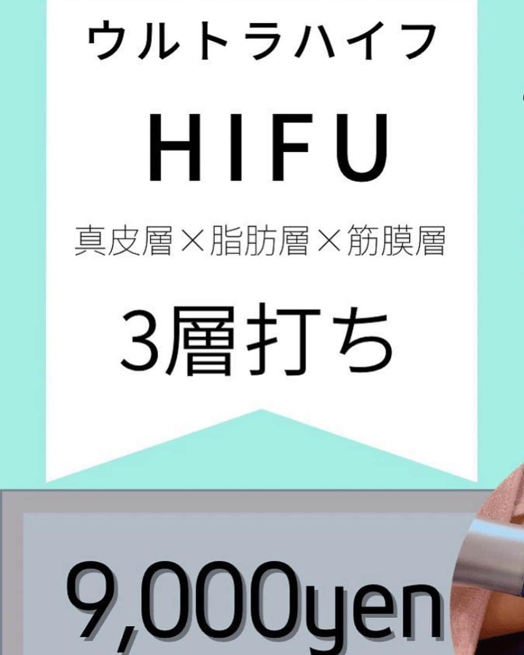 水田あゆみさんのインスタグラム写真 - (水田あゆみInstagram)「ここはデート前や撮影前とかにぜひ行ってほしい！！  行ったその場から顔がギューーーンって上がるウルトラハイフ😽 即効性ありすぎてビビるやつ🙌✨  脂肪層×筋膜層 二層打ち¥7500 真皮×脂肪層×筋膜層　三層打ち¥9000  と安すぎてまたビビるやつ🙌  気になるアゴ下とかもギューーンって上がる❗️ 効果音で説明しちゃって分かりにくいねごめん😂w  大人気剥けないハーブピーリング🌿もあって今度やってもらおかなと思ってます😻  私のフォロワーさんのためにと、 あゆ姉のインスタを見た！で予約してもらうとさらに初回10%OFFしてくれるそうです❤️  お安く綺麗になろう😊 大阪人はお得なものが好き！w」4月24日 11時52分 - ayune____