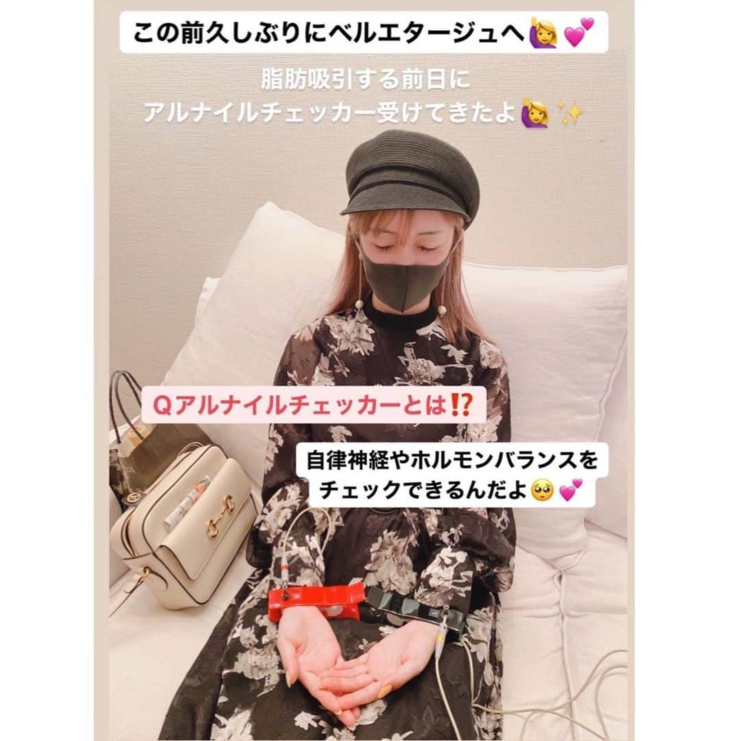 吉川ちえさんのインスタグラム写真 - (吉川ちえInstagram)「【脳🧠がリラックスするエステ✨】 . 脂肪吸引する前日にリラックスしてオペ挑みたいから 乃木坂にある脳リラエステ🧡🤍 @belletage_nogizaka へ🧚 . 今回もエステ受ける前は 心の身体のバランスを見る 自律神経チェッカー(アルナイルチェッカー✨)でストレス具合やオーラなどチェックしたよ🙋‍♀️🔥 . 相変わらず私はストレスに弱いみたい😂👐笑 その後は脳リラフェイシャル受けて、 身体も脳もリフレッシュ🤲❣️ . 今回はホルモンバランスを整える生炭酸パックも追加しました🥺✨ 肌がつるつるになるし脳🧠もリラックスできた~~🧚💕 . 《価格💰》 . ⭕自律神経チェッカー+美肌覚醒フェイシャル¥27,500 ⭕美肌覚醒フェイシャル¥22,000 🌸4月中は3周年キャンペーンで¥5,000オフ🌸 . #美肌覚醒フェイシャル #CBDフェイシャル #自律神経チェッカー」4月25日 12時44分 - yoshikawachie_16