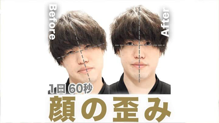 美容整体師川島さん。のインスタグラム：「あとから見返したい人は【保存マーク👇】 今回のような内容が好きな人は【いいねボタン👍】 で教えてください☺️ . ============================= [写真の時の顔の歪みを直す方法]  こんにちは、美容整体師の川島です👨‍⚕️  今回は「首の傾きを治す方法」 をみなさんに紹介します✨  首の傾きは、「僧帽筋」と「後頭下筋群」 二つの筋肉が関係していることが多いです！  この筋肉の歪みを取れれば 顔の左右差が取れたり姿勢が綺麗になりますよ！  ＜やり方＞ １、首のつまりを感じる側の手を後ろに回す ２、反対の手でしっかりと引っ張る ３、つまりを感じる側の首とは対側に頭を倒す  川島さんと一緒にストレッチして、 もっともっと首のつまりを取りたい方はYouTubeまで👨‍⚕️  #整体filament#川島悠希#美容整体師川島さん＃整体#美容#美容整体#マッサージ#運動#体の歪み#ストレッチ#猫背#猫背矯正#矯正#首のつまり#首のストレッチ#ストレートネック#姿勢矯正#スマホ首#簡単ストレッチ#自宅トレーニング#ホームケア#美容垢#背中痩せ#整体師#首#背中#セルフケア#セルフケア講座#僧帽筋#後頭下筋群」