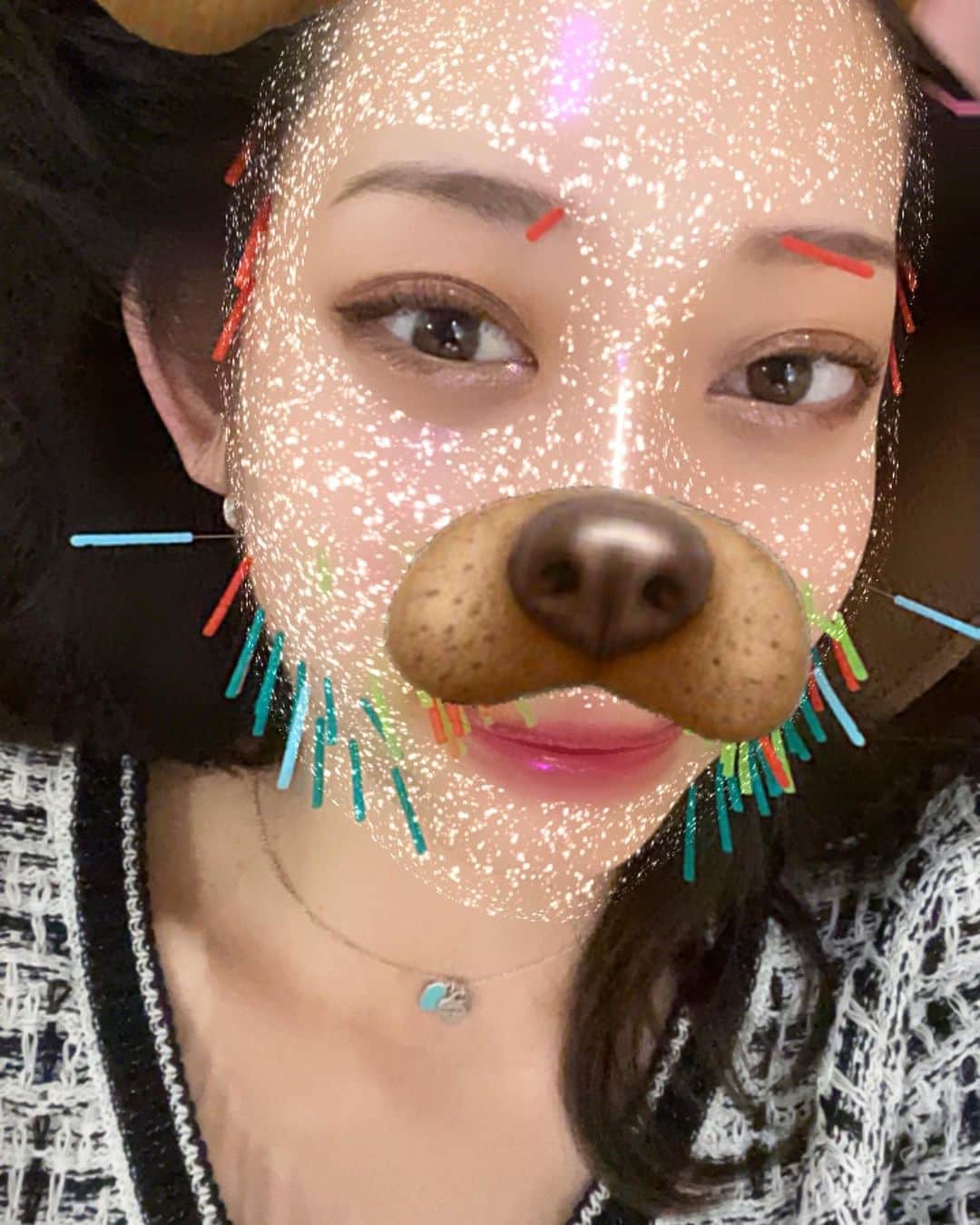 瀬名ひなののインスタグラム：「いつもお世話になってる美容鍼すこやか先生 @ebisu_sucoyaca ✌️今日はいつにも増して顔が一回り、いや二回り小さくなりましたありがとうございます☺️いつもどうやったらTikTokがバズるか話してたらついにすこやか先生のTikTokがバズりました🎉おめでとうございます！毎日いろんなとこに効くツボを紹介してくれてるのでぜひ痩せたい方二日酔いの方便秘の方などは見てみてください💁‍♀️そして小顔になりたい方はぜひ美容鍼受けてみてください、ほんとに全然変わる🙆‍♀️ #美容鍼 #3枚目は雨に打たれ電流に引きつられたノーマルカメラ」