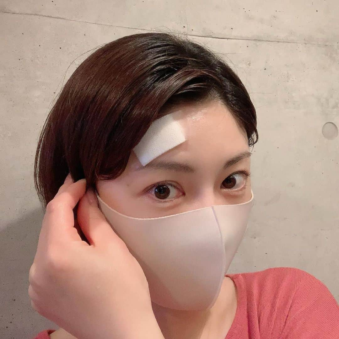 原史奈さんのインスタグラム写真 - (原史奈Instagram)「皆様ご心配おかけしました💦 病院に行ってお薬頂いてきました！ 少々痛々しい写真になっていますが 至って元気です‼️ 1週間くらいしたら治るのでは無いか ということでした 一瞬コテで触れてしまっただけなのに結構な火傷になるものですね。。 気をつけないと😰 #病院 #行ってきました #皮膚科 #ご心配おかけしました #みんな温かい #気をつけます ﻿﻿﻿#原史奈 #ゴルフ #ゴルフレッスン #ゴルフ女子#ゴルフ大好き #golf #ゴルフウエア #ゴルフコーデ #ゴルフグッズ #ゴルフ動画 #ping #ピン #ping女子 #gle2 #g410 #even #archivio #アルチビオ #cuartounited #instagolf」5月13日 16時01分 - fuminahara