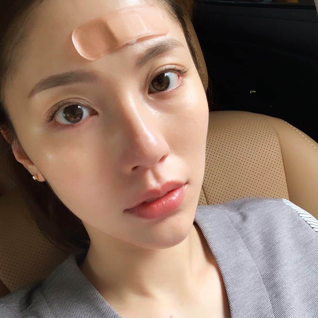 ニキビ オロナイン 絆創膏