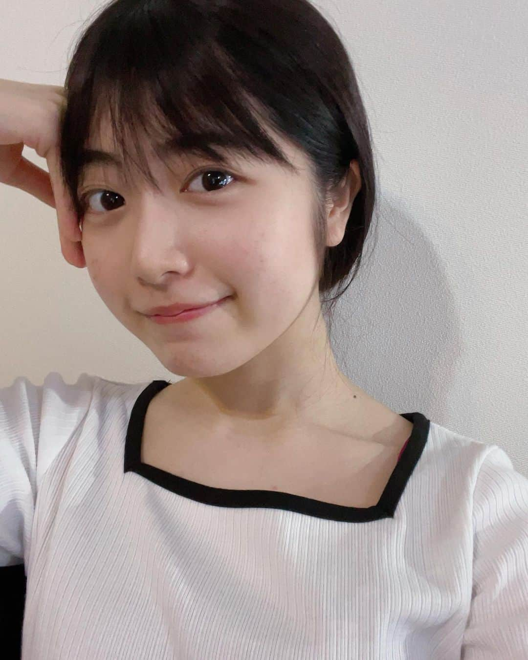 吉田莉桜さんのインスタグラム写真 - (吉田莉桜Instagram)「先日、お肌を綺麗にしてもらいました！ ・ なかなかニキビの跡とか消えてくれなくて 悩んでたんですけど、施術してもらってからものすごく肌の調子が良くなりました✨ ・ おでこに内出血してるのハズカシィ、、笑 ・ スタッフさんもすごく話しやすくて、自分に足りていないものを教えて頂けて良かったです！！ ・ ・ ・  #アンリミット #クリスティーナ#ハーブピーリング#カーボキシー#ハリウッドブロウリフト#血流からアプローチ」6月10日 21時29分 - yoshida_rio_official