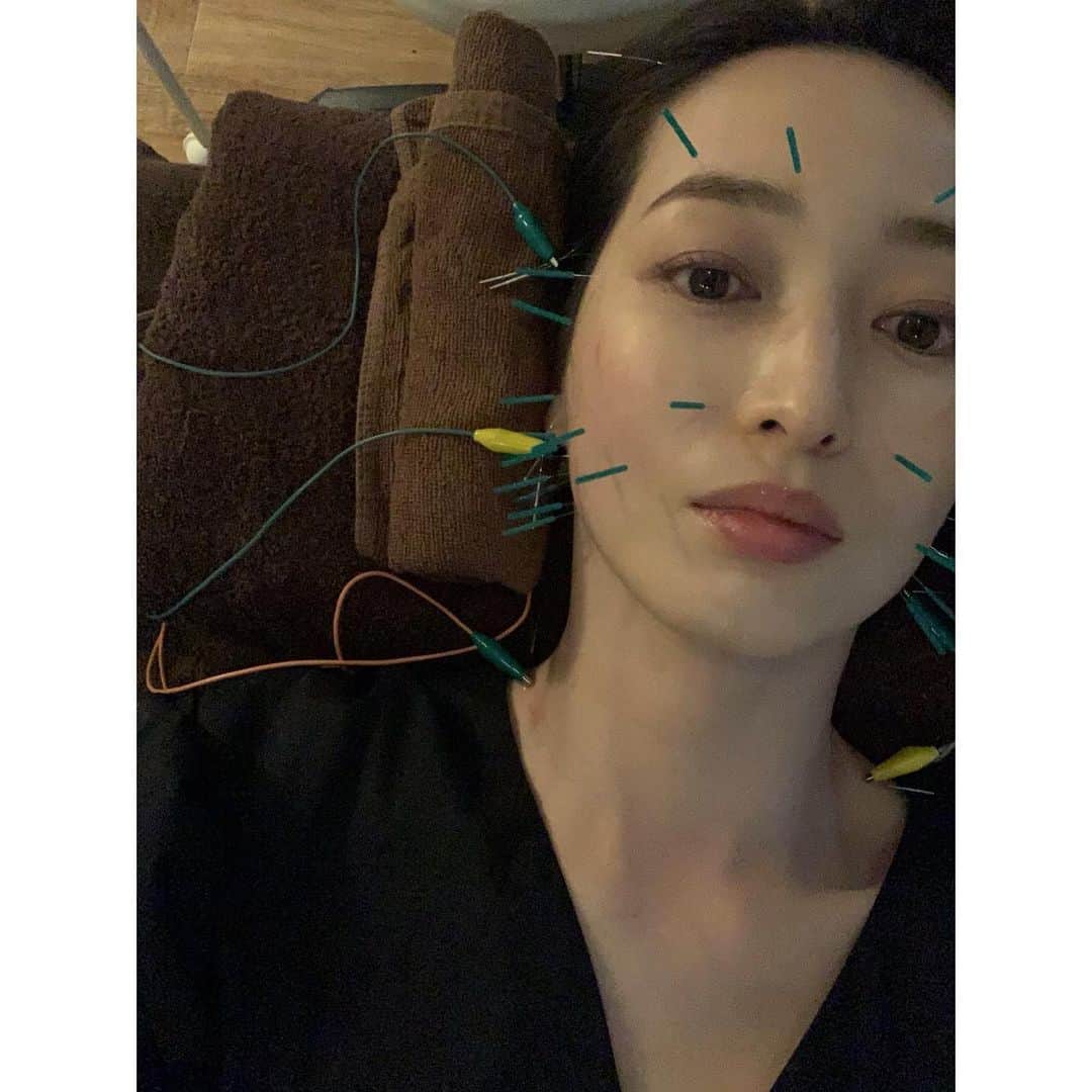 上野なつひさんのインスタグラム写真 - (上野なつひInstagram)「可愛いワンピって悩まなくていいしサラッとオシャレに着れる🐥🌱 お友達の @maako_hinahina のブランドのネックレスが合わせやすくてお気に入り☺️  初の鍼治療に行ってきたよ！☘️ 凄いね、あれ！効果絶大！ エラの筋肉？歯の食いしばり強かったんだけど鍼で柔らかくしてもらったらスッキリしたし食いしばりが緩和された🥺👏 アンド日に日に顔がスッキリして痩せていく！！すごすぎて感動😍肩こりもあるって言ったら頭と肩と首もやってくれて血流良くなって顔がほんのり赤い！ストレートネックだから疲れやすいらしい💦 緩和ケアの先生だから安心だった！  @fuku_total_body_maintenance  ありがとうございました👏」5月19日 18時26分 - natsuhi