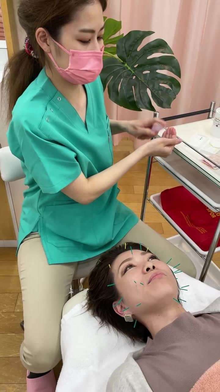 札幌ベルエポック美容専門学校 公式のインスタグラム：「美容針で小顔交換抜群❗️」