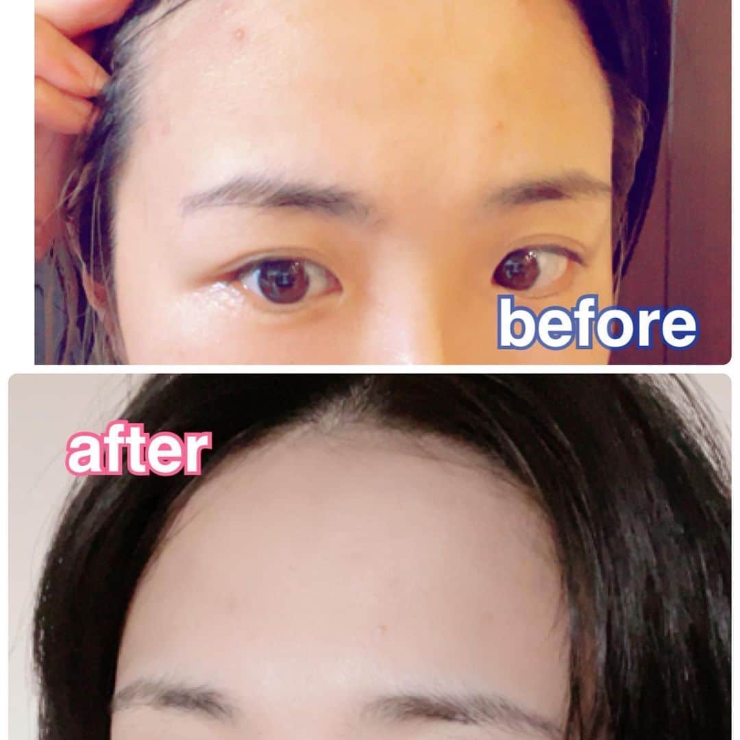 森本レオ子さんのインスタグラム写真 - (森本レオ子Instagram)「・ もともとお肌には自信があったのですが、最近肌荒れが酷いので#ルルルン プレシャスGREEN  を夜のお手入れに取り入れました😉 ・ シートがもっちもちで吸い付いてくれるから、全然剥がれてこないのが最高😆😆液だれもないので、パックをしながら食器を洗ったりのちょっとした家事ができるます。夜の時間は常に修羅場な主婦の味方😂🤣 ・ 気になっていたおでこ周辺の肌荒れも一週間でしっかり良くなりました🥰🥰惜しみなく毎日使えるので助かりまくりです🧝🏻‍♀️🧚‍♀️🌈 ・ 美容液がたっぷり染み込んでいるので、剥がした後のシートでさらに全身の保湿もしちゃってます✨ ・ 🌈ルルルンプレシャスGREEN🌈 https://online.lululun.com/  @lululun_jp #lululun #ルルルン #ルルルンプレシャス #プレシャスグリーン #フェイスパック #フェイスマスク #エイジングケア #ルルルンスキンケアルーティン#sponsored #follop @follop.jp」5月28日 20時57分 - leocodon