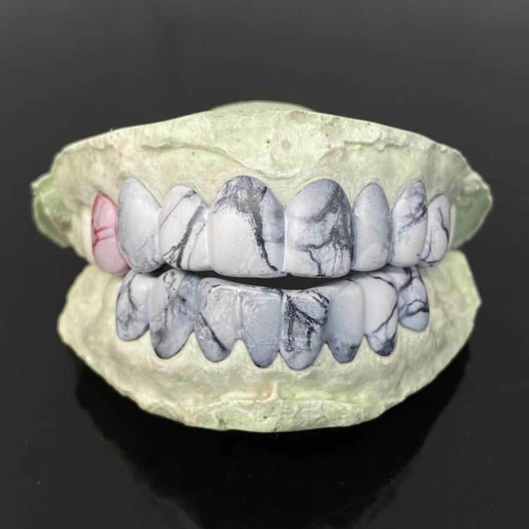 オカモトレイジのインスタグラム：「Next Game Changer Grillz "Marble"🪨💎✨ @grillzjewelz_is_right × @matsumoto_tsukiita 「錆」の次は「大理石」これも多分世界初👌 #grillz #marble #grillzjewelz #大理石 #グリルズ」