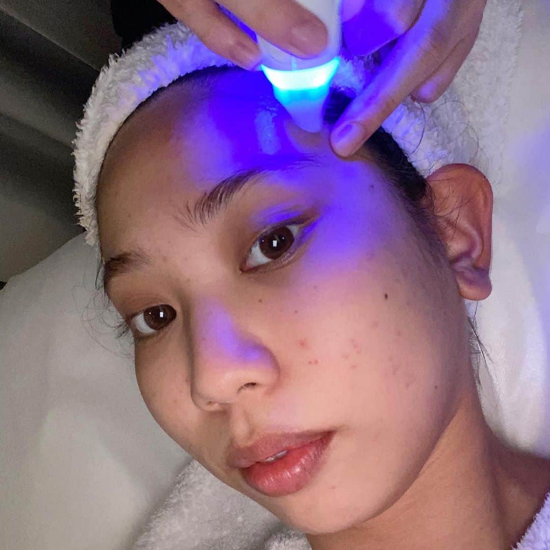 薬丸玲美さんのインスタグラム写真 - (薬丸玲美Instagram)「ハイドラフェイシャル受けてきました✨  ニキビやニキビ跡、毛穴の黒ずみが気になっていたので 私の悩みに効果的な #ハイドラポアレスコース に即決定🙆🏻‍♀️  おかげさまで 次の日の触り心地と化粧ノリが 最高すぎたぁ！💕😌  Salon do Shéllenさんで やらせてもらったのですが サロンの雰囲気がとても素敵でした❣️  気になる方はShéllenさんのアカウントを チェックしてみてください✨ @shellen_salon   Shéllenさんありがとうございました🥰  #salondoshellen #shellen #フェイシャルサロン #広尾 #南麻布 #ハイドラフェイシャル #ハイドラポアレス」7月3日 23時44分 - remi_yakumaru