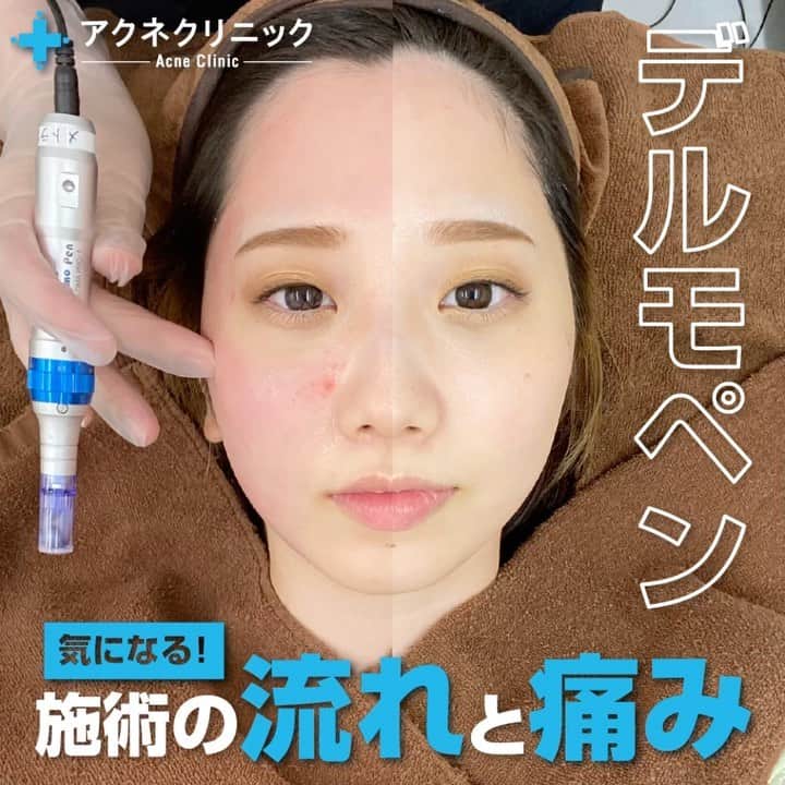 東京アクネクリニックのインスタグラム