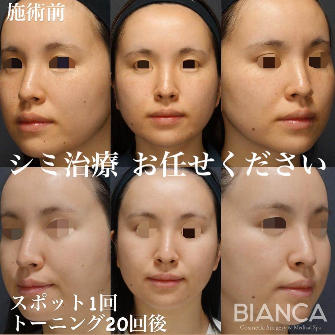辻沢由有（BIANCA CLNIC 表参道院 院長）のインスタグラム