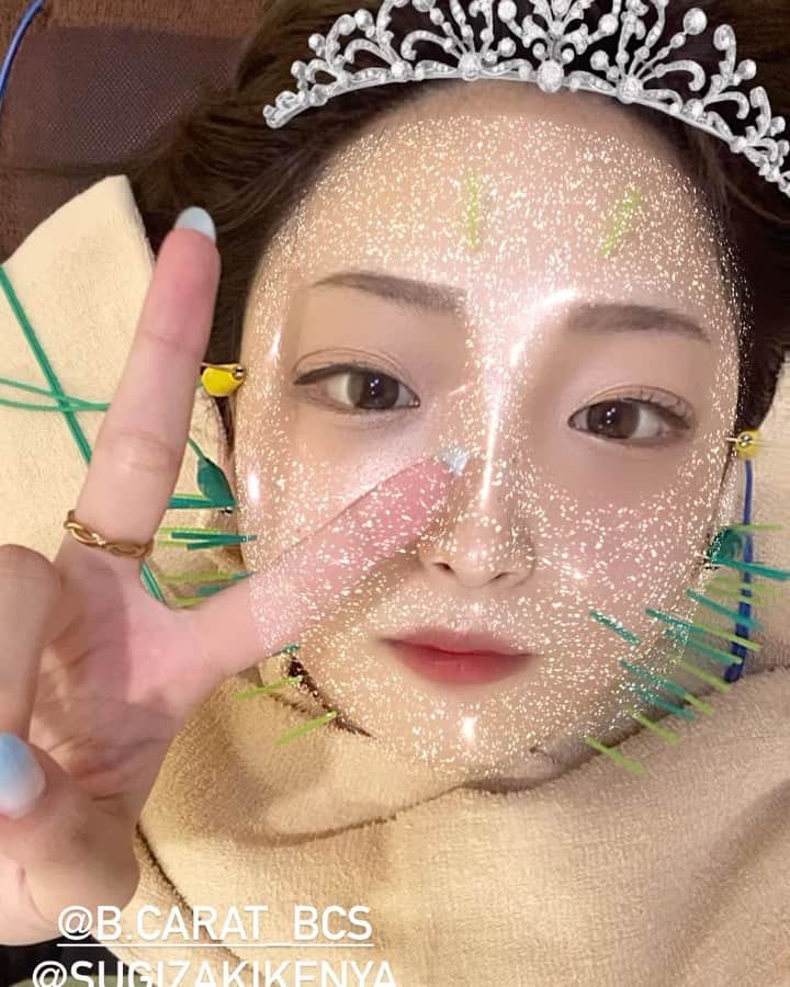 鈴木双葉のインスタグラム：「. 顔に鍼さしてます🦔✨  初めて打って4回経ちました、お顔が小さくなってきて嬉しいです૮₍´｡• ᵕ •｡`₎ა . 今日は身体もやってもらいました、肩甲骨はがし最高だった⸜(* ॑ ॑* )⸝  . . . #金髪院長 #きゅきゅっと美容鍼 #BCARAT #美容鍼 #鍼 #ハリネズミ #自撮り #渋谷 #美容」