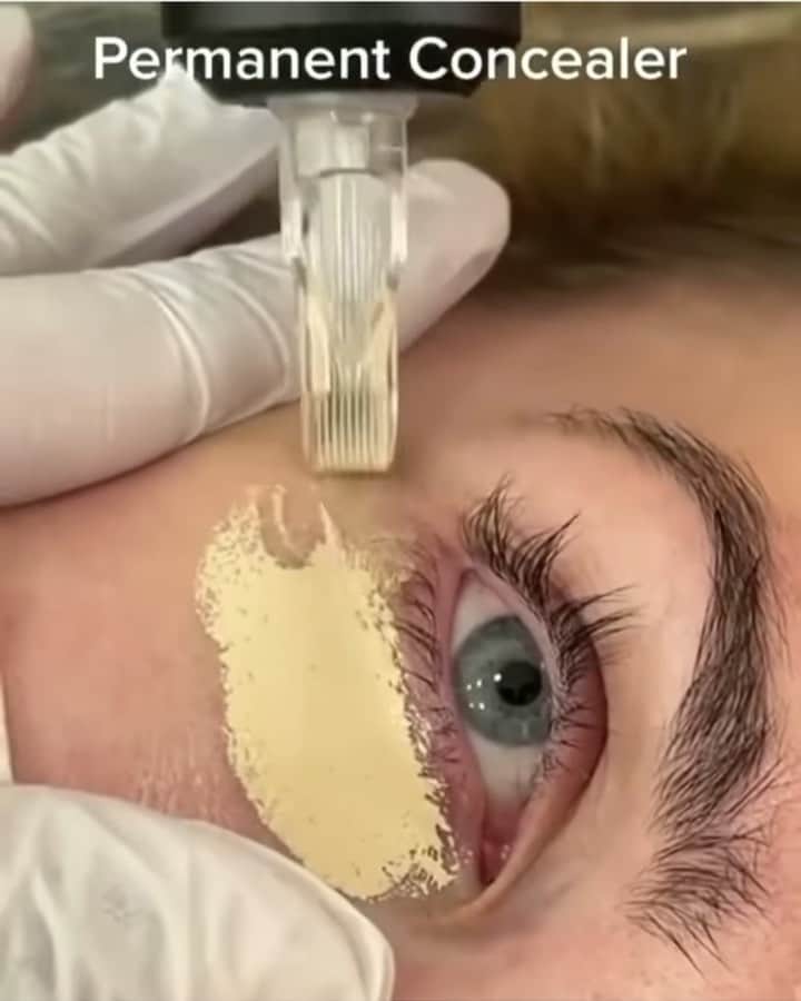 Fashion Climaxxのインスタグラム：「Permanent concealer? 😱 what do you guys think of this? @glamboxheidelberg before & after pics in Stories」