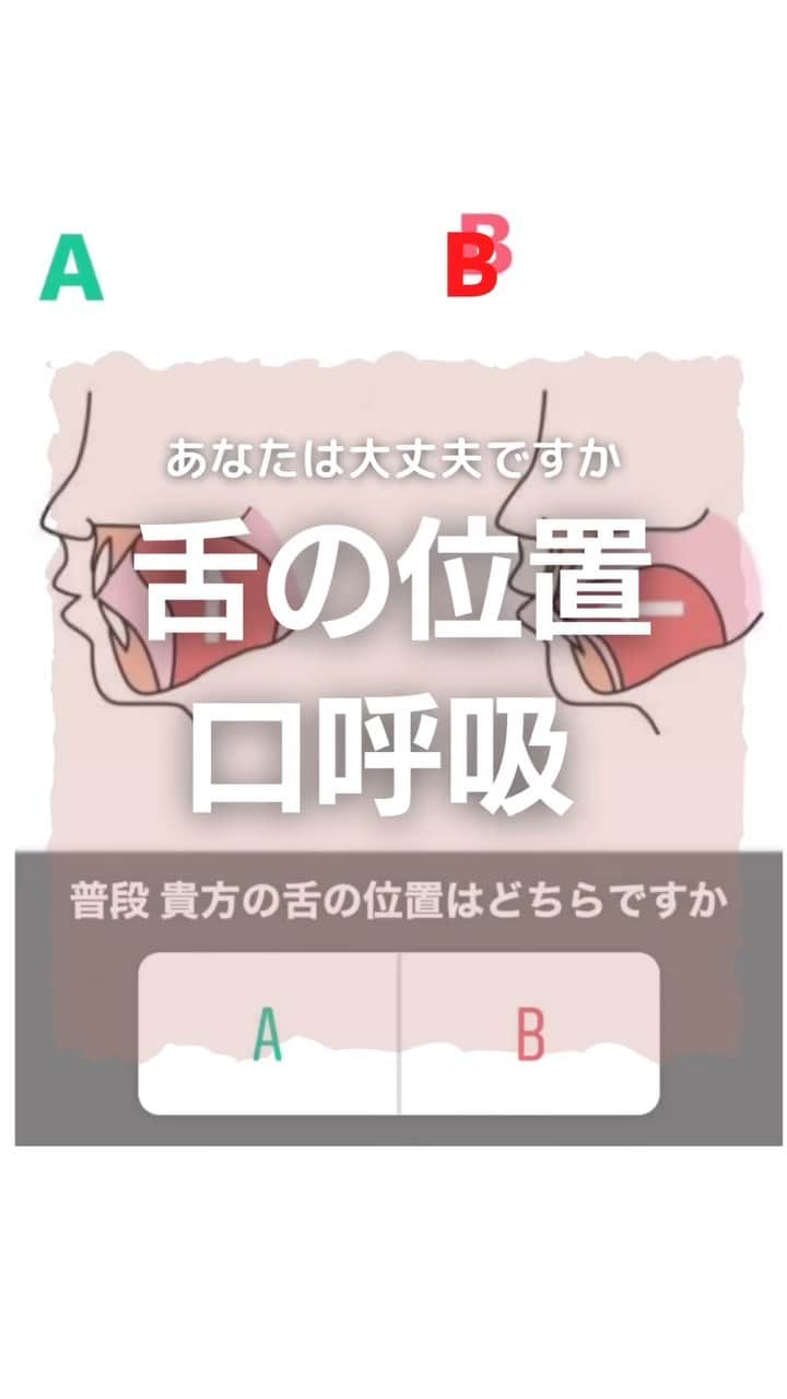 kogao283のインスタグラム：「#意外に知られていない口呼吸の弊害と鼻呼吸の重要性について  鼻の呼吸では、空気の通り道が狭く、 ゆっくり吸気されるため、取り入れられる空気は温められ、 水分も含むようになります。  さらに、鼻とのどとの境目にある扁桃組織 （咽頭扁桃、アデノイドともいう）に 花粉やウイルス、ハウスダストなどが付着することで、  #免疫機能が働き異物を排除すると考えられています👃🏻  つまり、鼻で呼吸することで、  #冷たく乾燥した外気が加温・加湿されるとともに、  #異物が気管支や肺に直接取り込まれることも 避けられるわけです☝️  　ところが口呼吸では、 外気がそのまま取り込まれるため、 口の中や気道が乾燥し、 のどに炎症や痛みが起こったり、 のどの両脇にある扁桃腺（口蓋扁桃）の腫れ などが起きやすくなります。  また異物やウイルスも直接侵入するため、 インフルエンザなどの感染症にも罹りやすくなります。  　鼻がつまって口呼吸になると、 「のどがヒリヒリする」「のどがカラカラに乾燥する」 と感じますが、 鼻呼吸によって取り入れる空気は、 柔らかく、湿度を持っていて温かいのです。 そのことからも鼻呼吸の良さが分かります。  口呼吸が引き起こす体の不調  　最近は、口呼吸の弊害に注目し、 「口呼吸が病気の原因となっている」という見地に立って、 治療と並行し鼻呼吸を指導する医師が増えています。   　様々な体の不調は、口呼吸が原因であることも想定されるため日ごろから鼻呼吸に切り替えるよう努めることが大切です。  また、身体の不調以外にも 歯並びや顎の変形も、、、  .  LINE ｢@kogao283｣ @マーク含む」