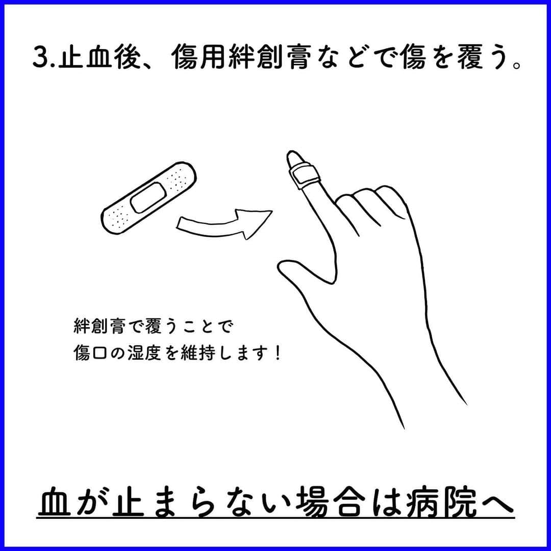 TOKYO MER～走る緊急救命室～さんのインスタグラム写真 - (TOKYO MER～走る緊急救命室～Instagram)「\医学豆知識💡/  今回は「包丁で指を切ってしまった時」  出血が多いと慌ててしまいますが、何より止血が大事！ その止血も間違ったやり方していませんか？  正しい方法を覚えましょう✔︎  --------------------------------------------------- TBS日曜劇場『TOKYO MER〜走る緊急救命室』 毎週日曜よる9時〜放送 主演: #鈴木亮平  ---------------------------------------------------  #tokyomer」7月18日 21時56分 - tokyo_mer_tbs